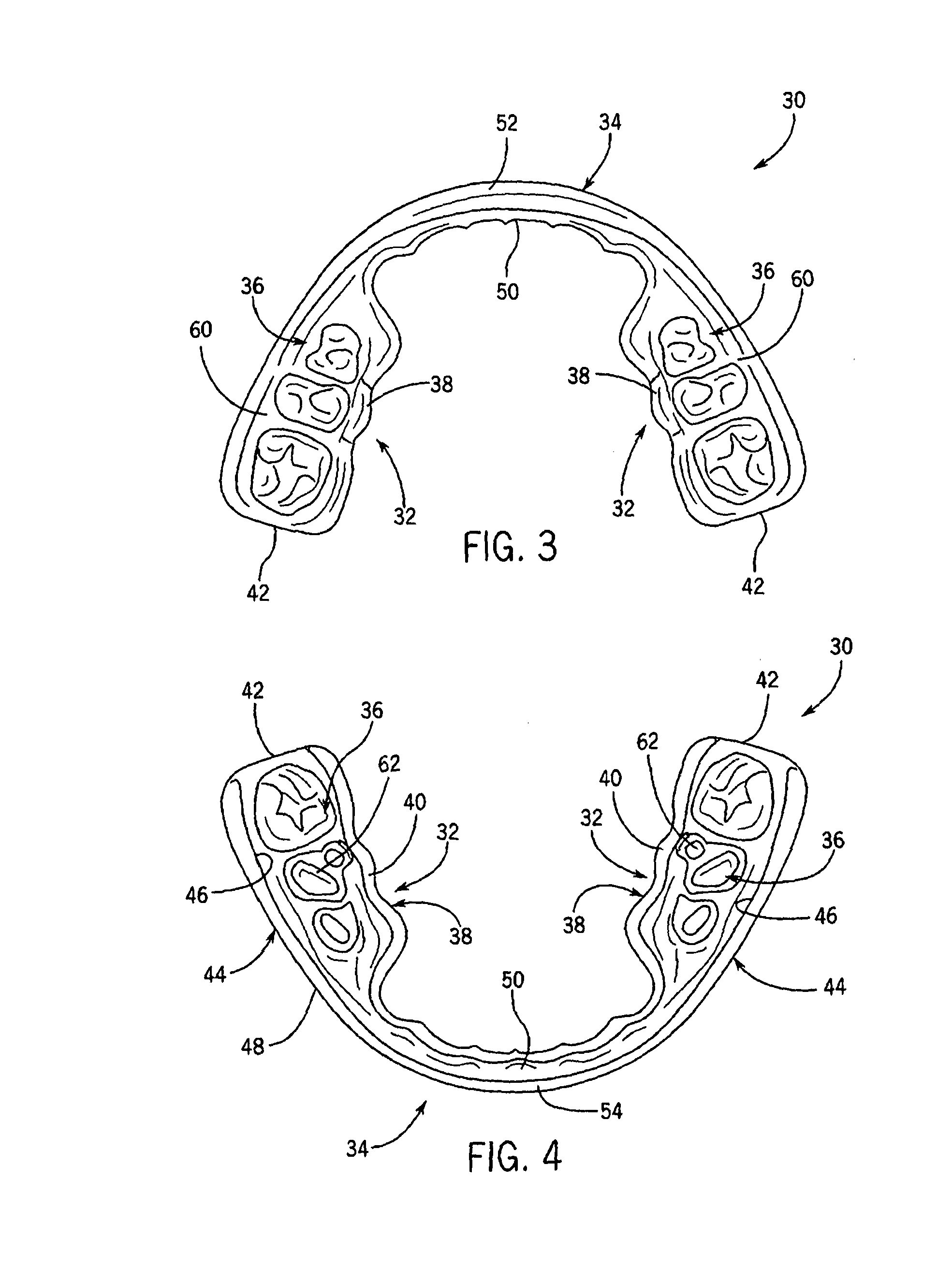 Performance enhancing bite regulator and self-impression system and method of custom fitting same