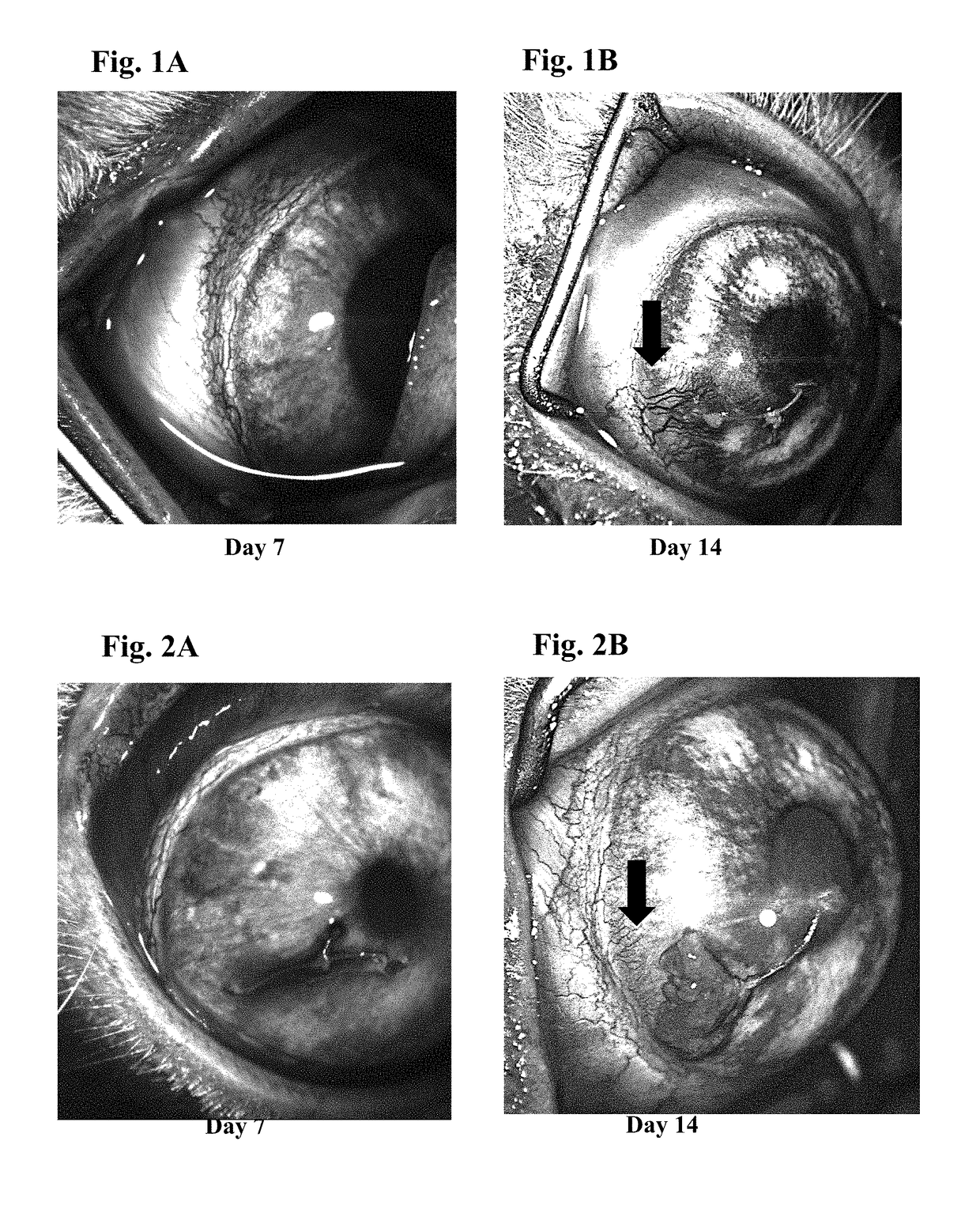 Ophthalmic formulations of tyrosine kinase inhibitors, methods of use thereof, and preparation methods thereof