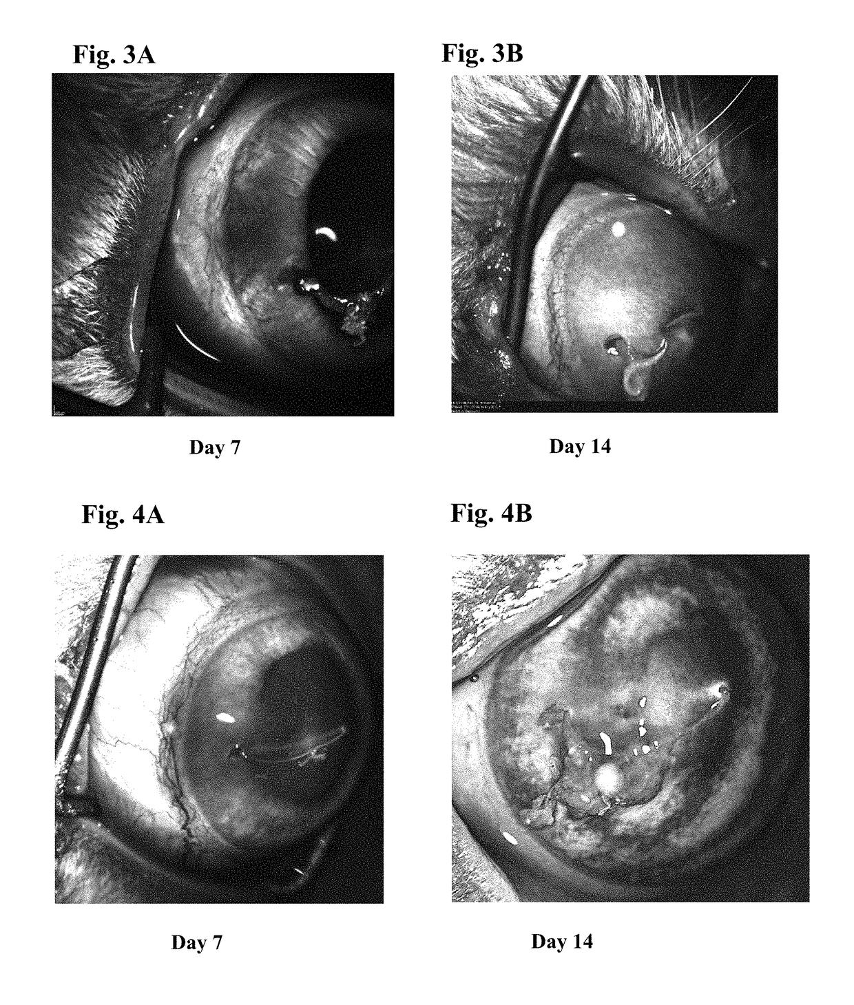 Ophthalmic formulations of tyrosine kinase inhibitors, methods of use thereof, and preparation methods thereof