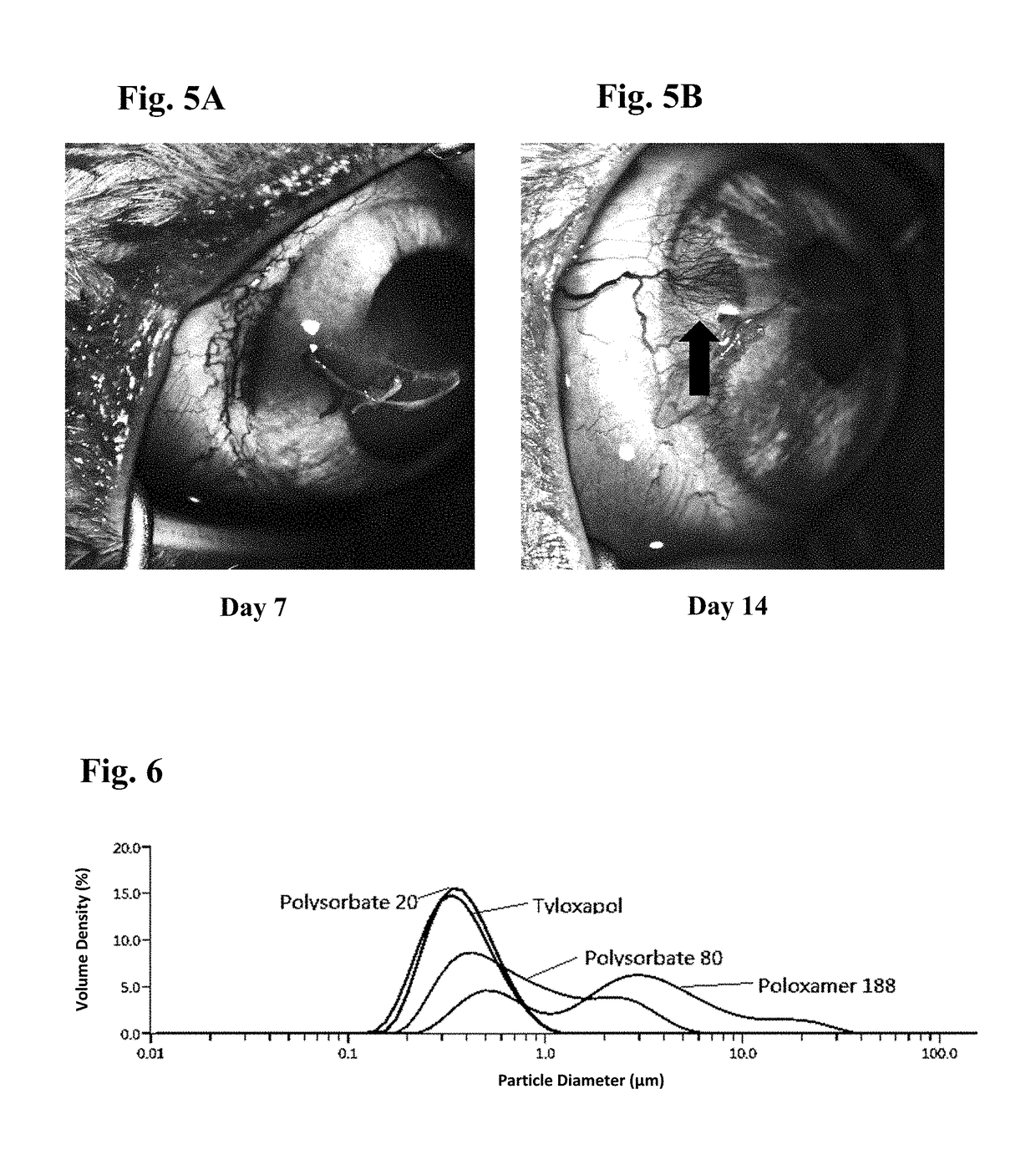 Ophthalmic formulations of tyrosine kinase inhibitors, methods of use thereof, and preparation methods thereof