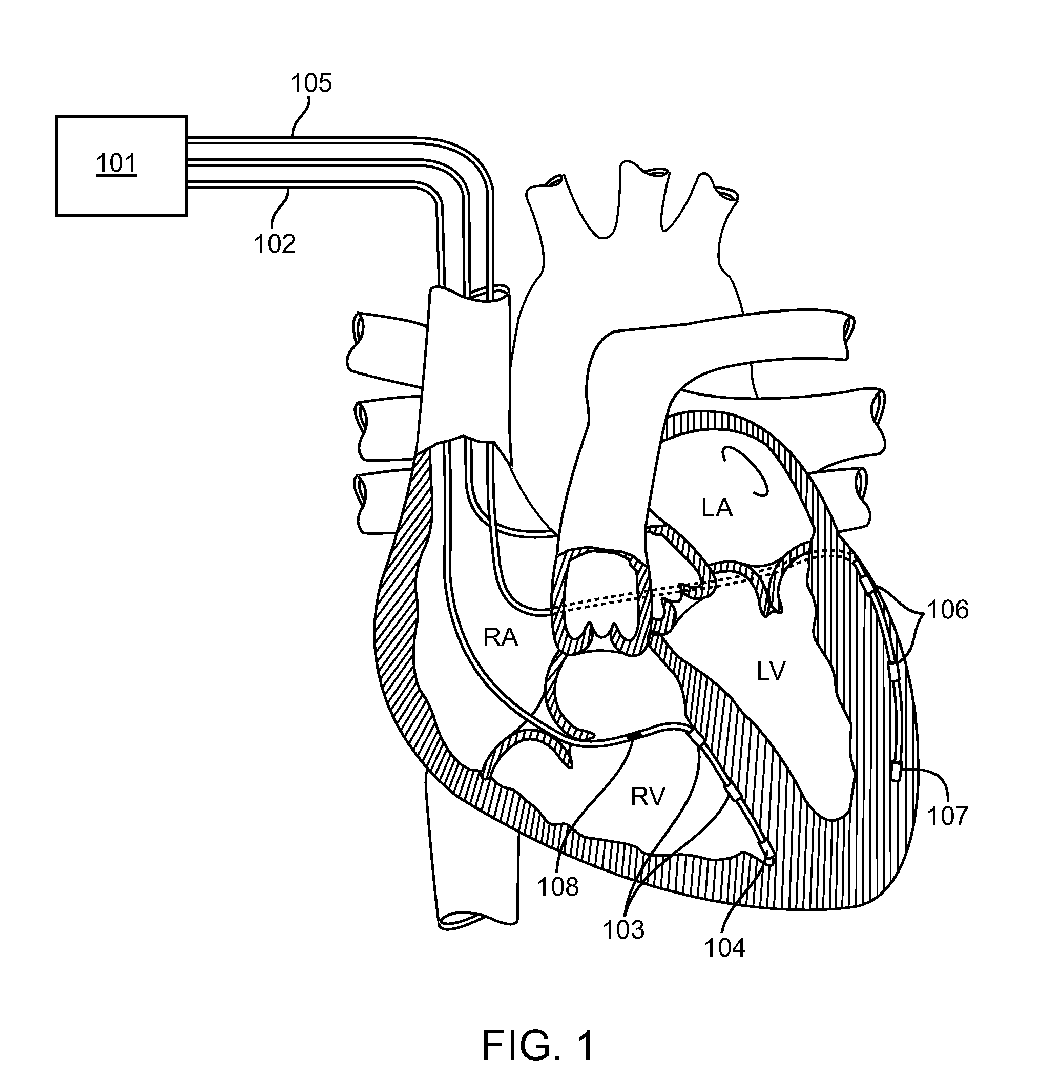 Self-referencing communication in implantable devices