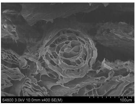 A kind of preparation method of flexible and bendable aluminum ion battery