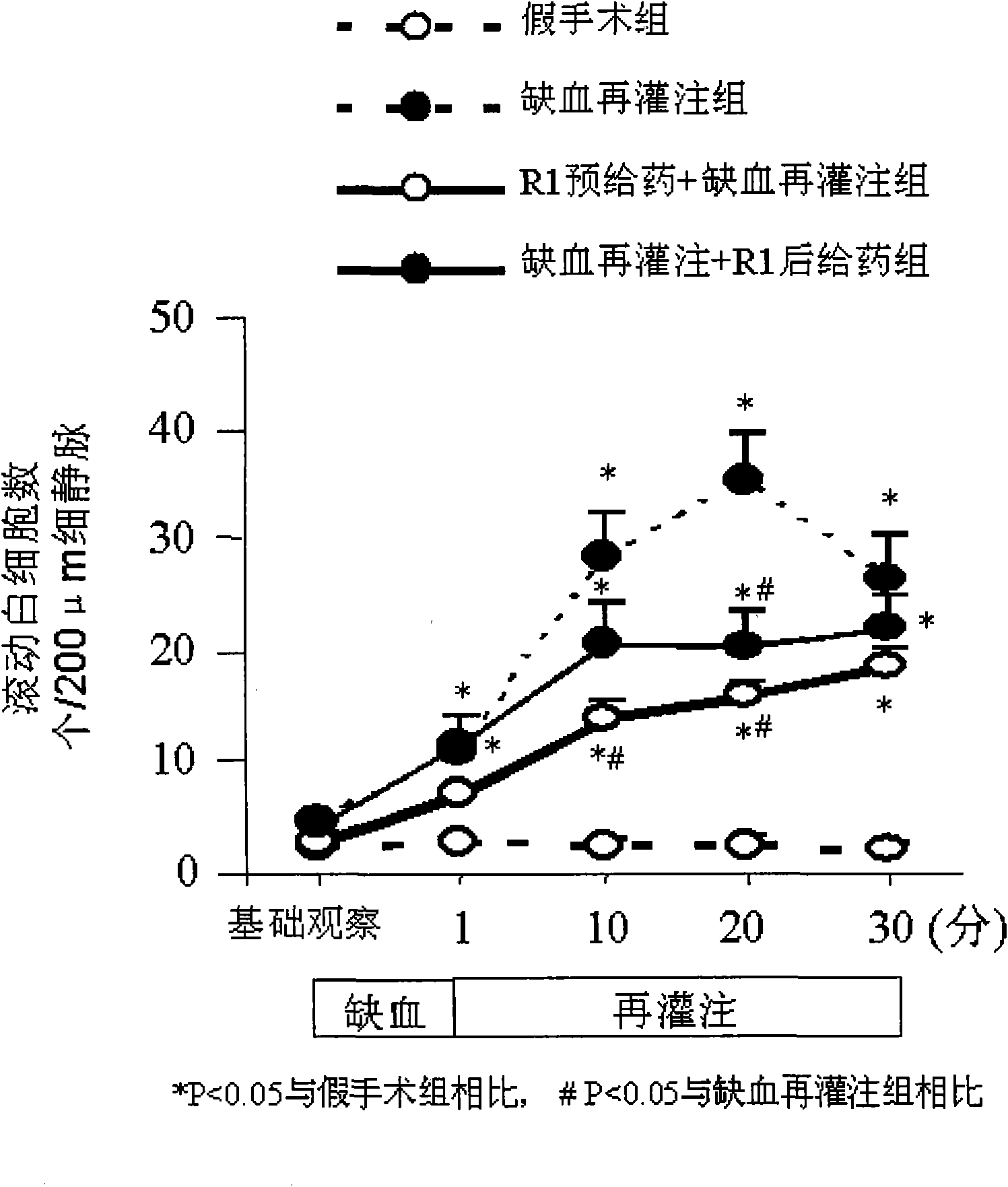 Prevention and treatment of diseases induced by microcirculation disturbance with panax notoginseng saponins R1