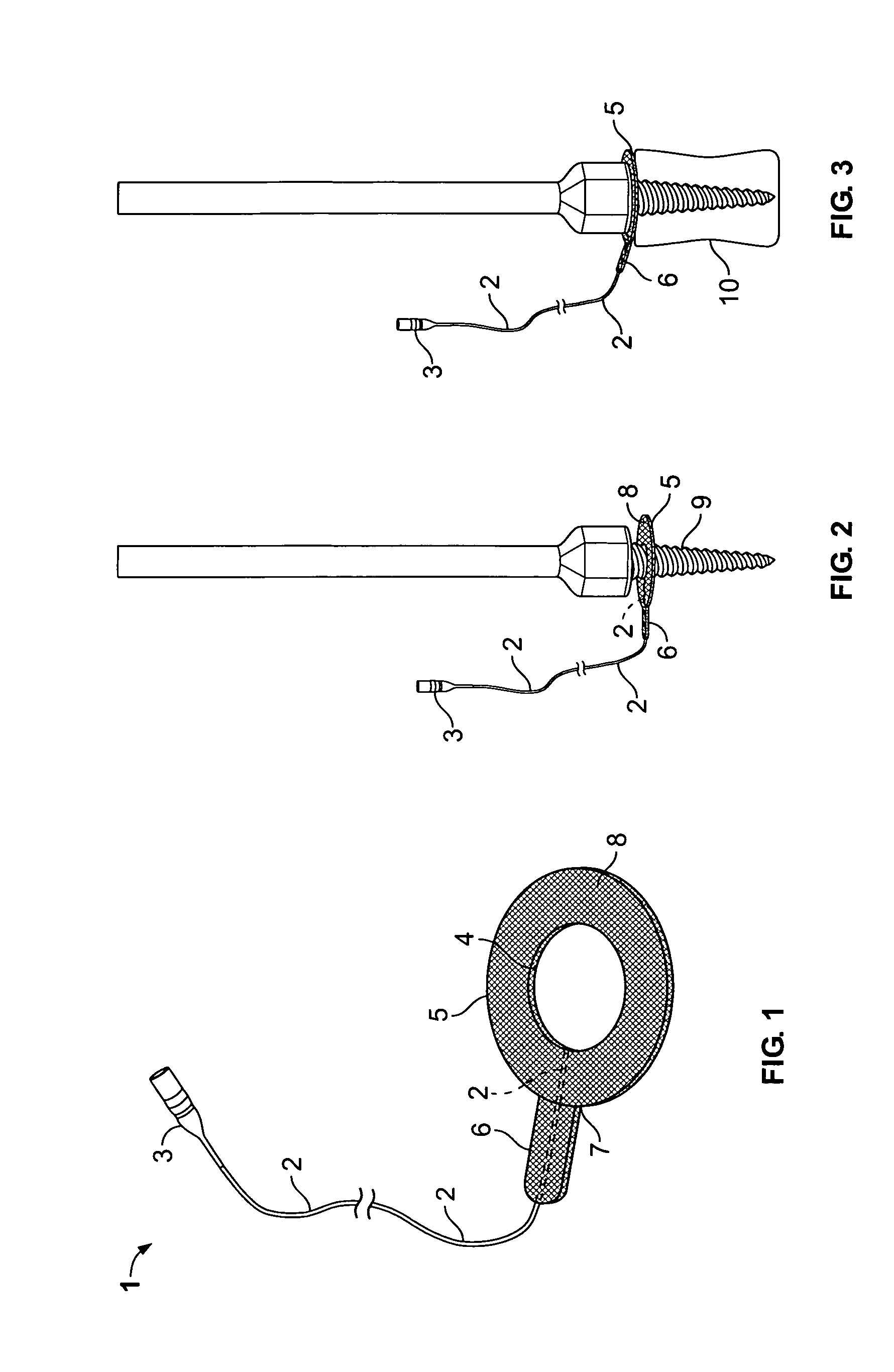 Ring electrode