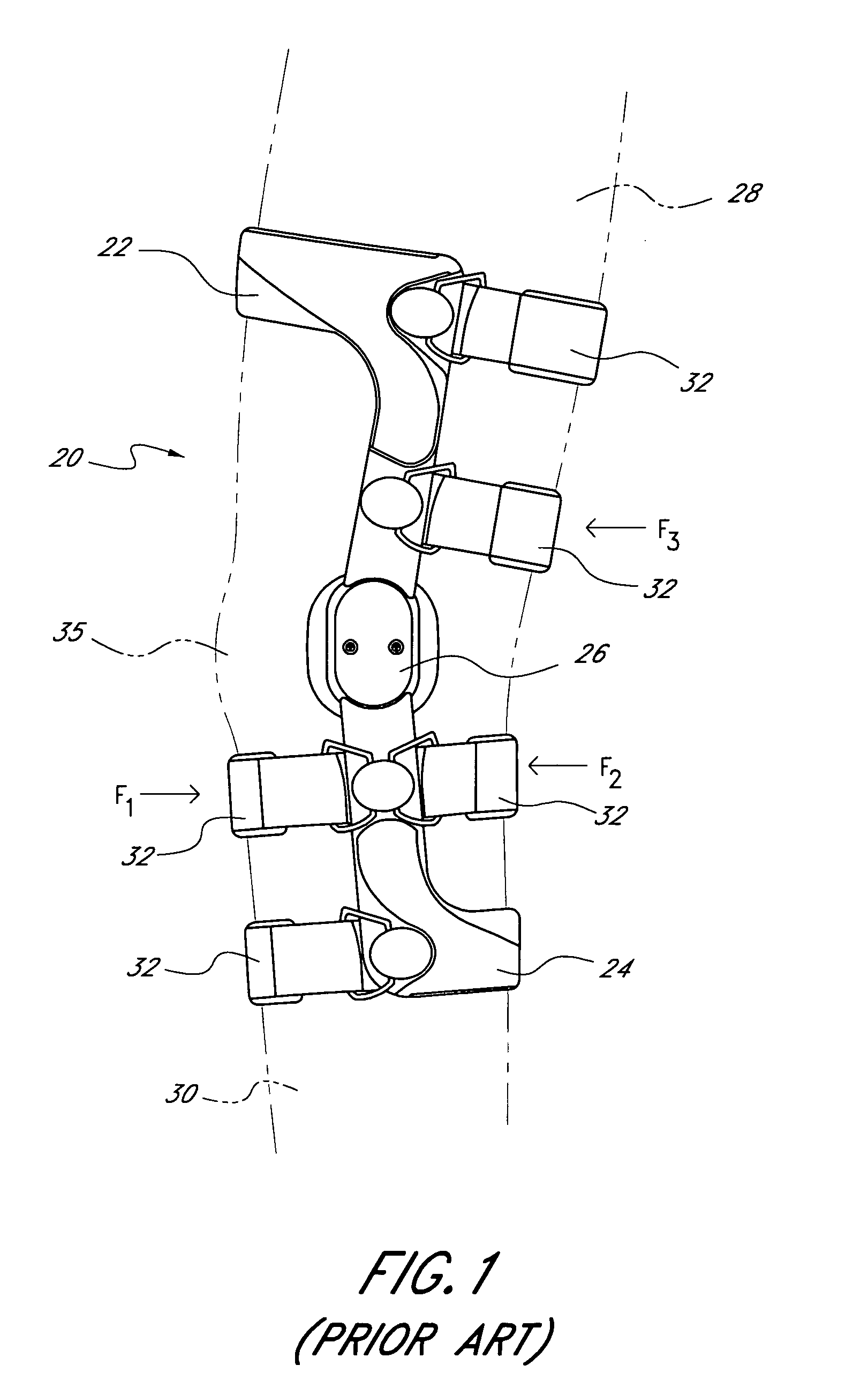 Strap tension indicator for orthopedic brace