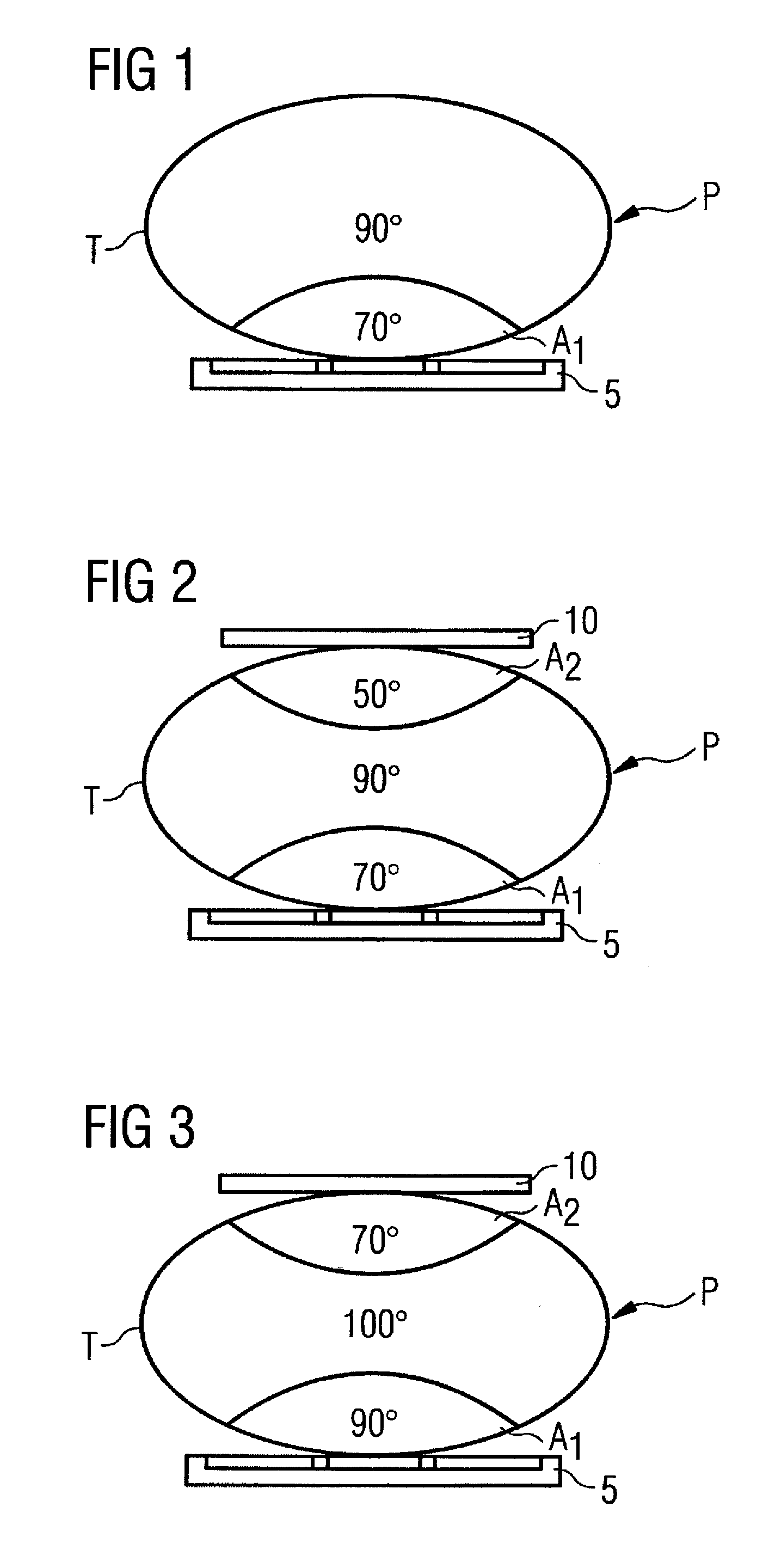 Magnetic resonance apparatus, method and auxilliary coil element for manipulation of the b1 field