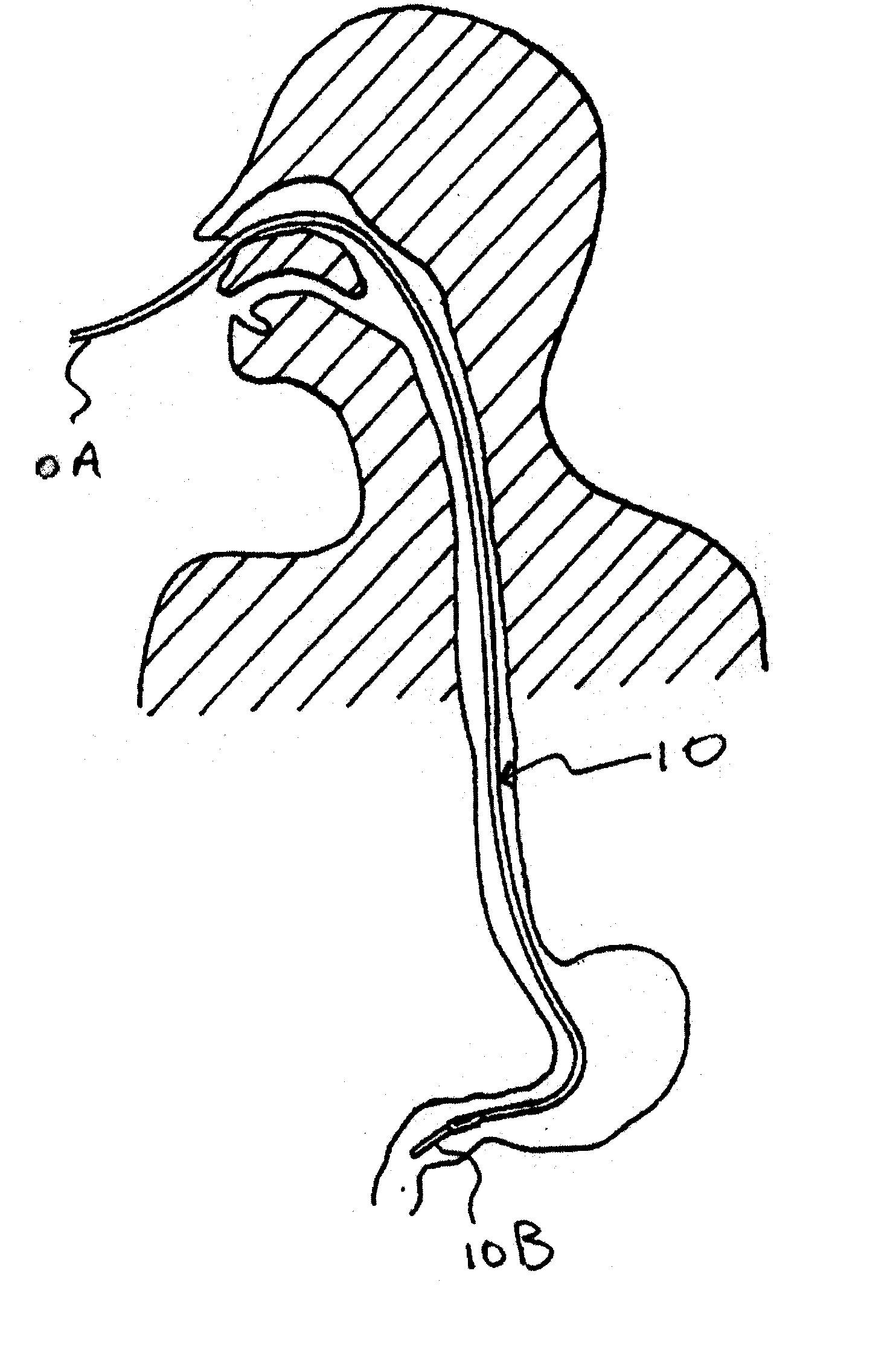 Probiotic/Prebiotic Composition and Delivery Method