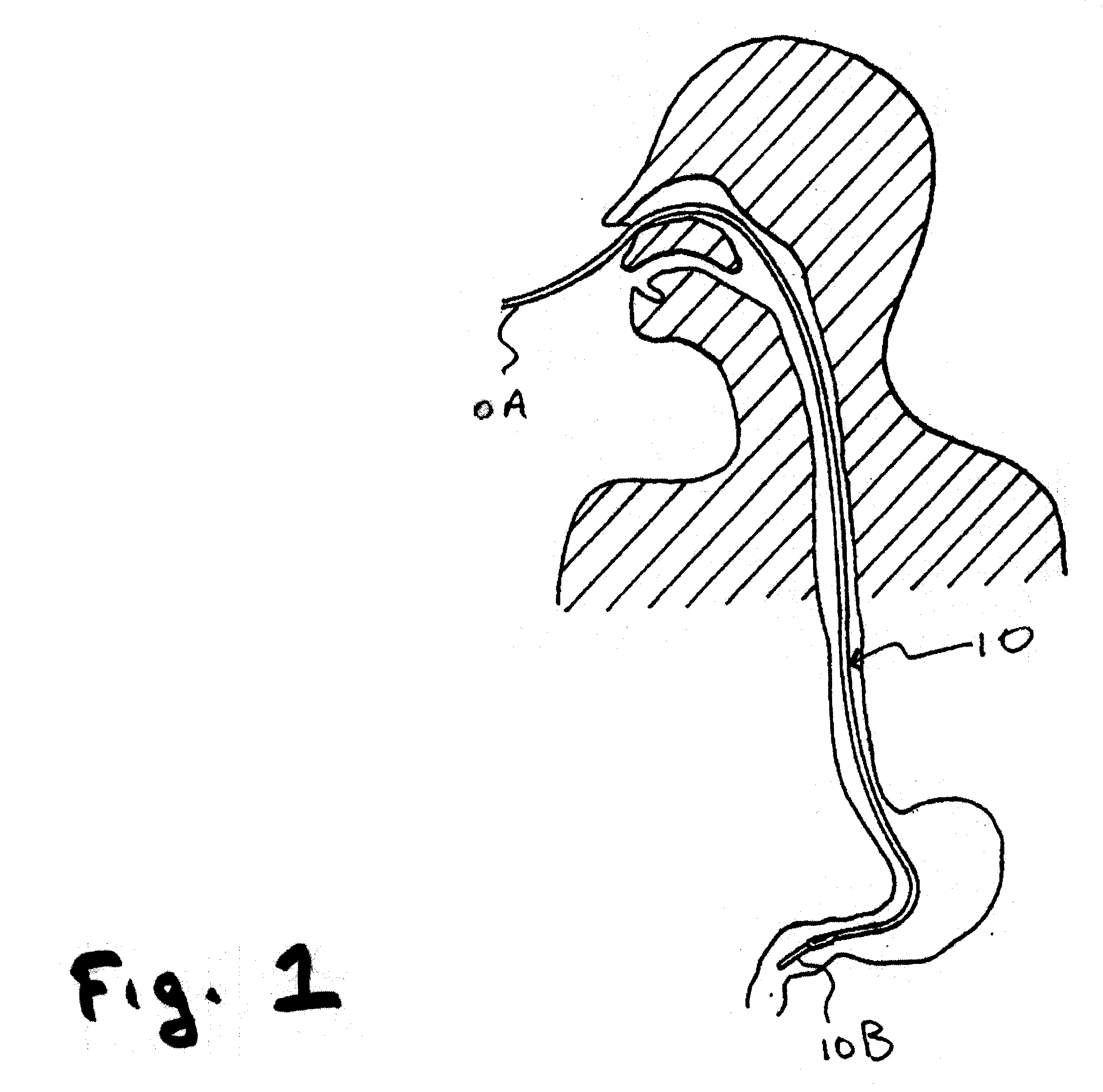 Probiotic/Prebiotic Composition and Delivery Method