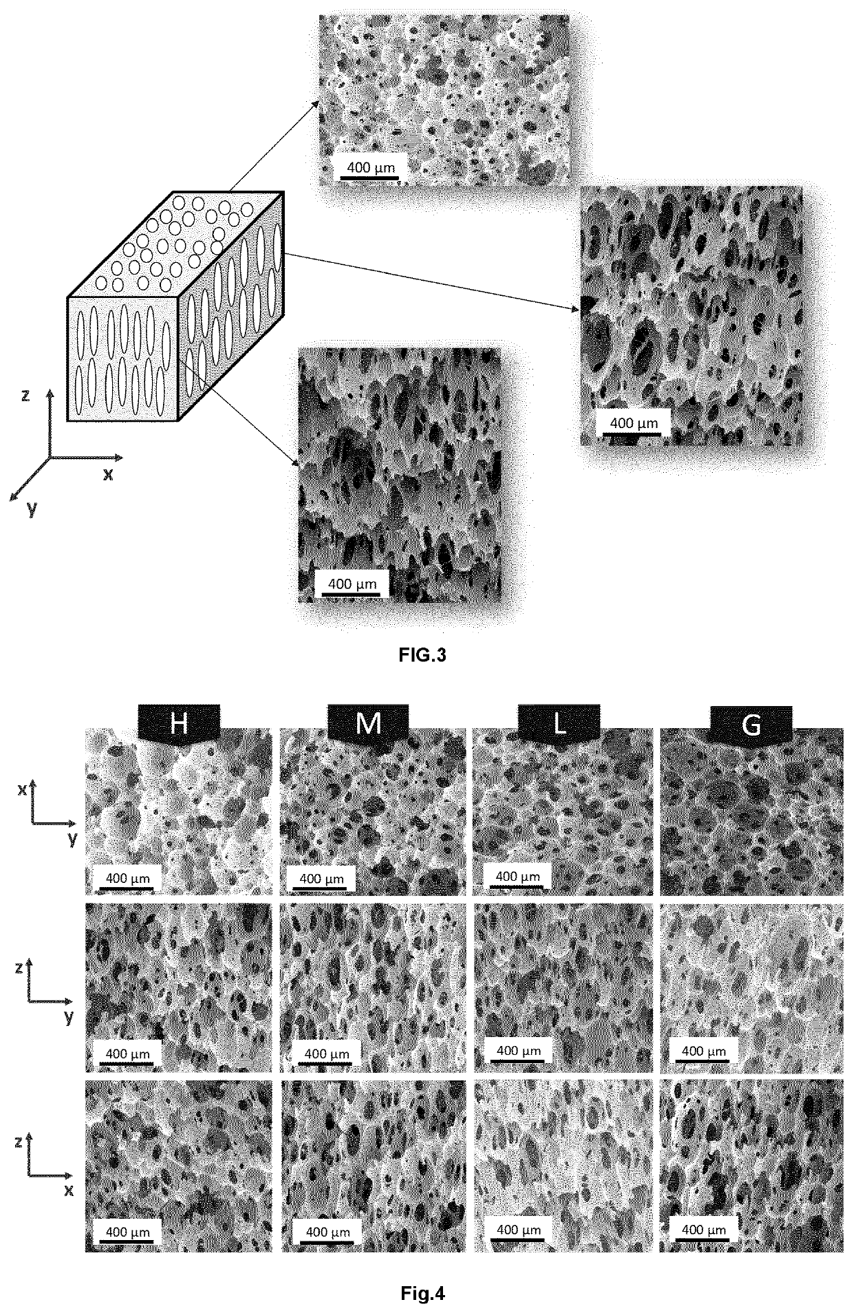 Absorbent articles having an anisotropic foam acquisition layer