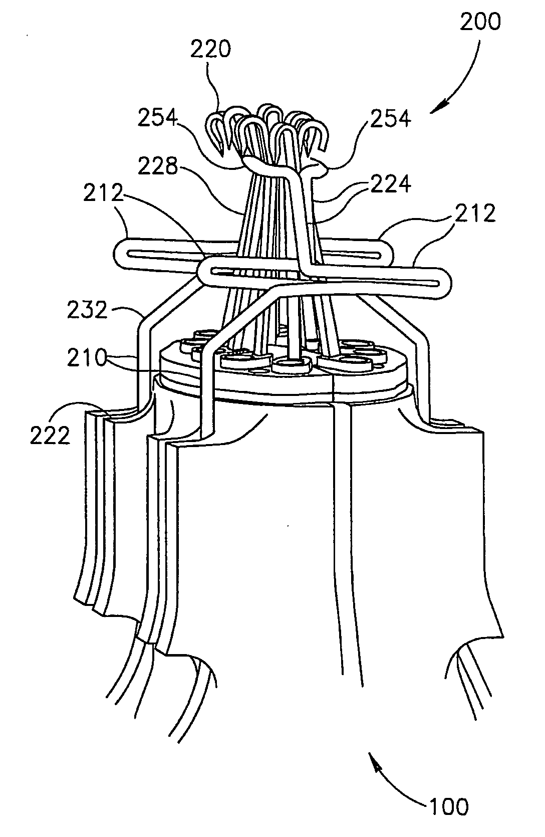 Anastomotic leg arrangement