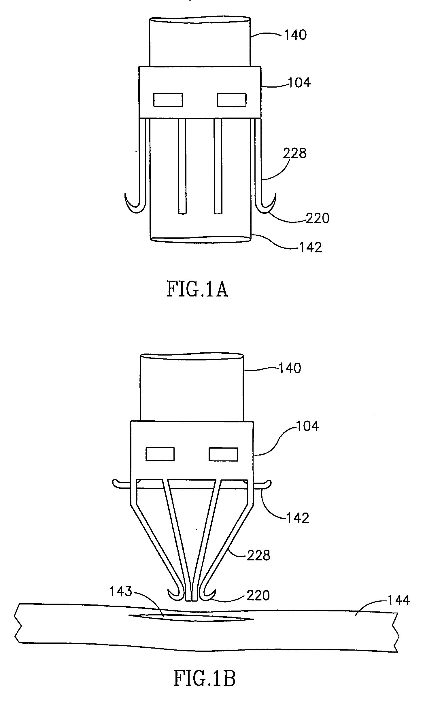 Anastomotic leg arrangement