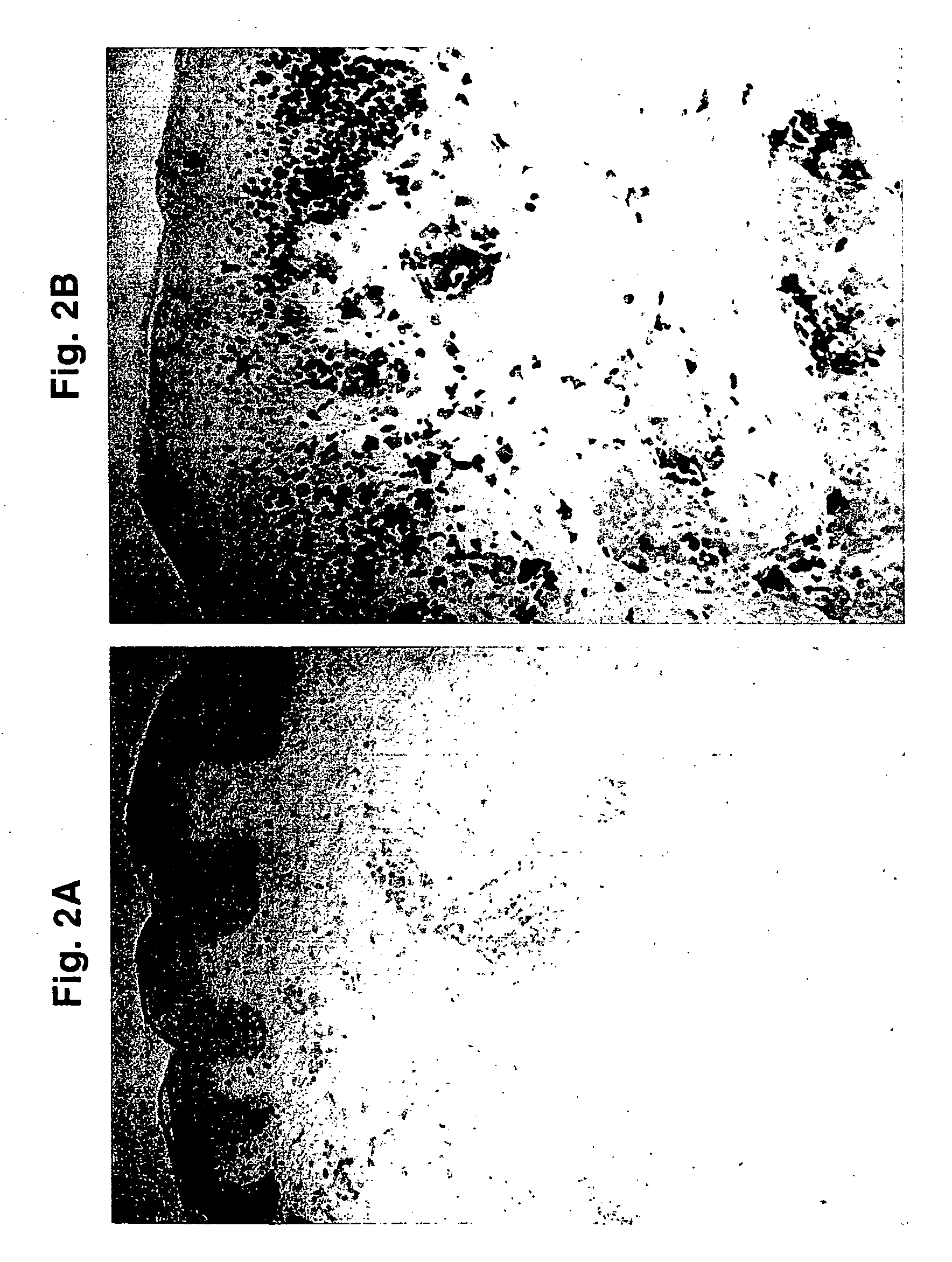 Compositions and methods for use against acne-induced inflammation and dermal matrix-degrading enzymes