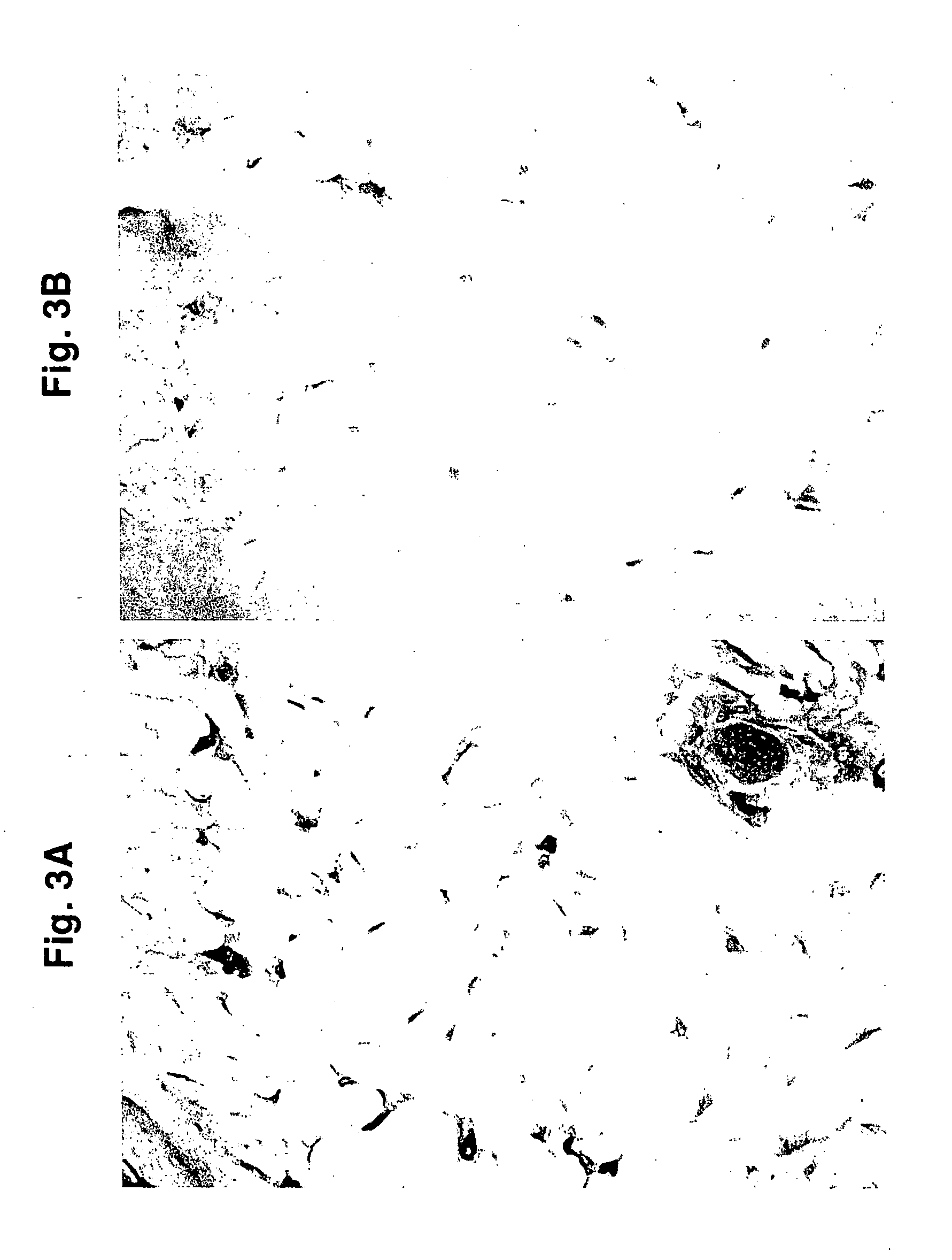 Compositions and methods for use against acne-induced inflammation and dermal matrix-degrading enzymes