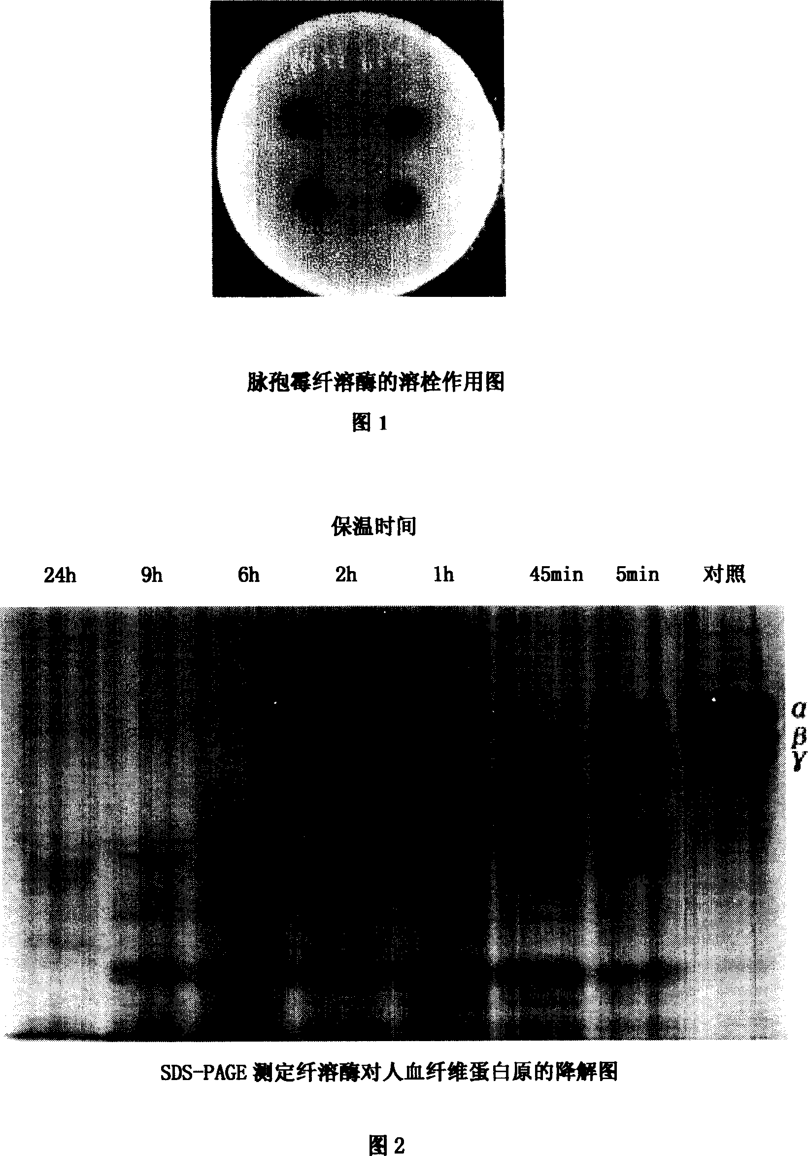 Plasminogen and cultivation method therefor