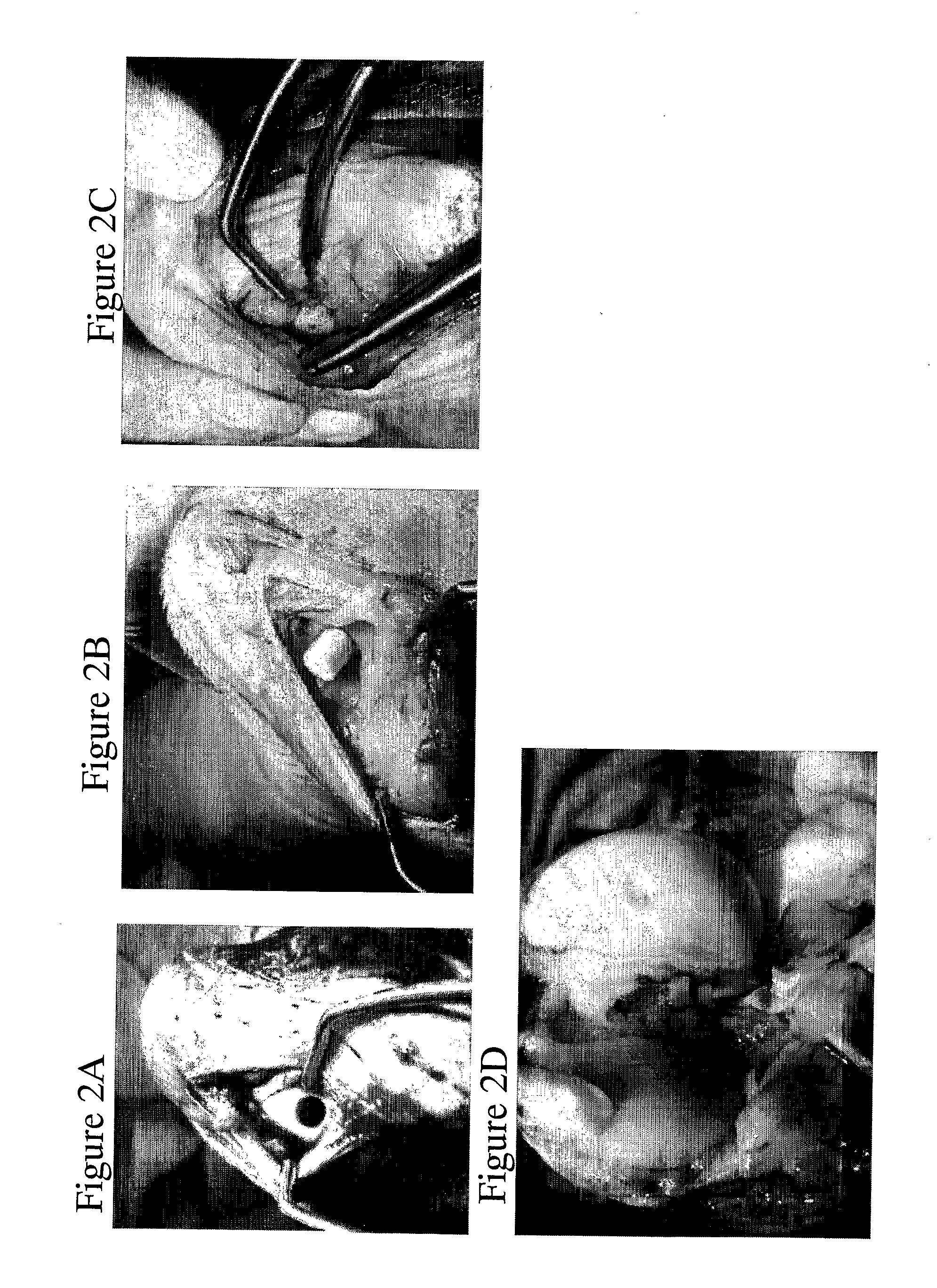 Solid Forms for Tissue Repair