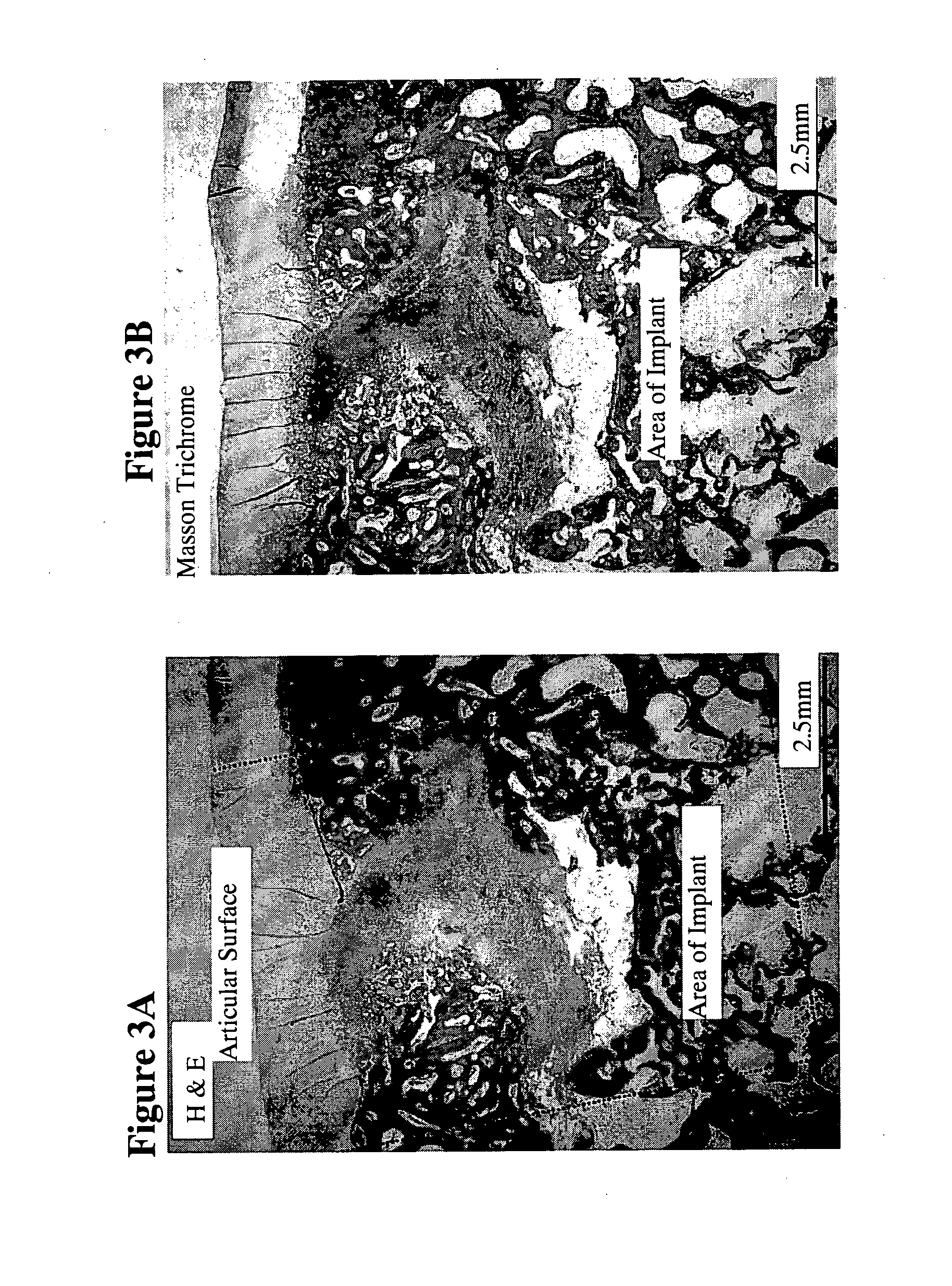 Solid Forms for Tissue Repair