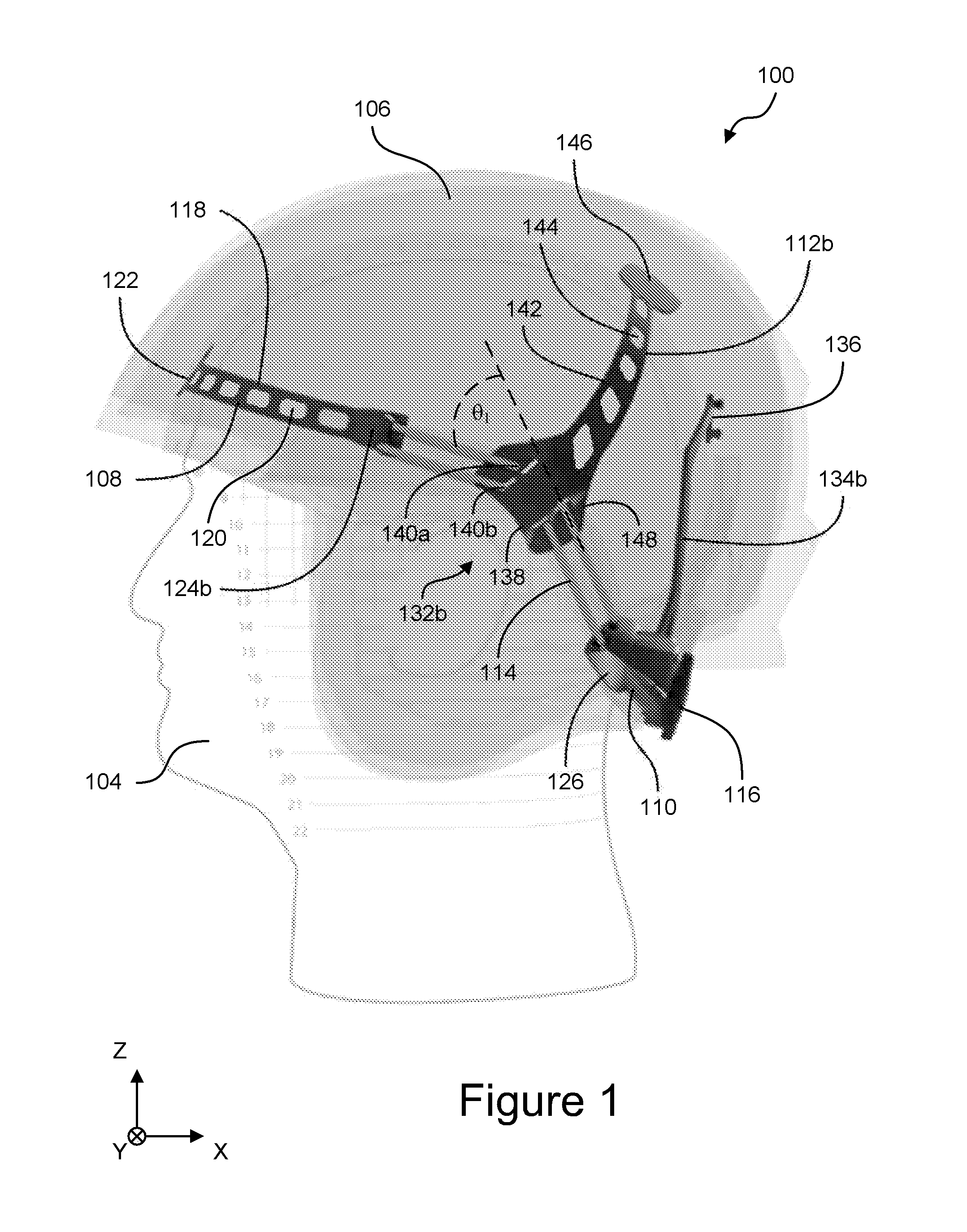 Tightening systems