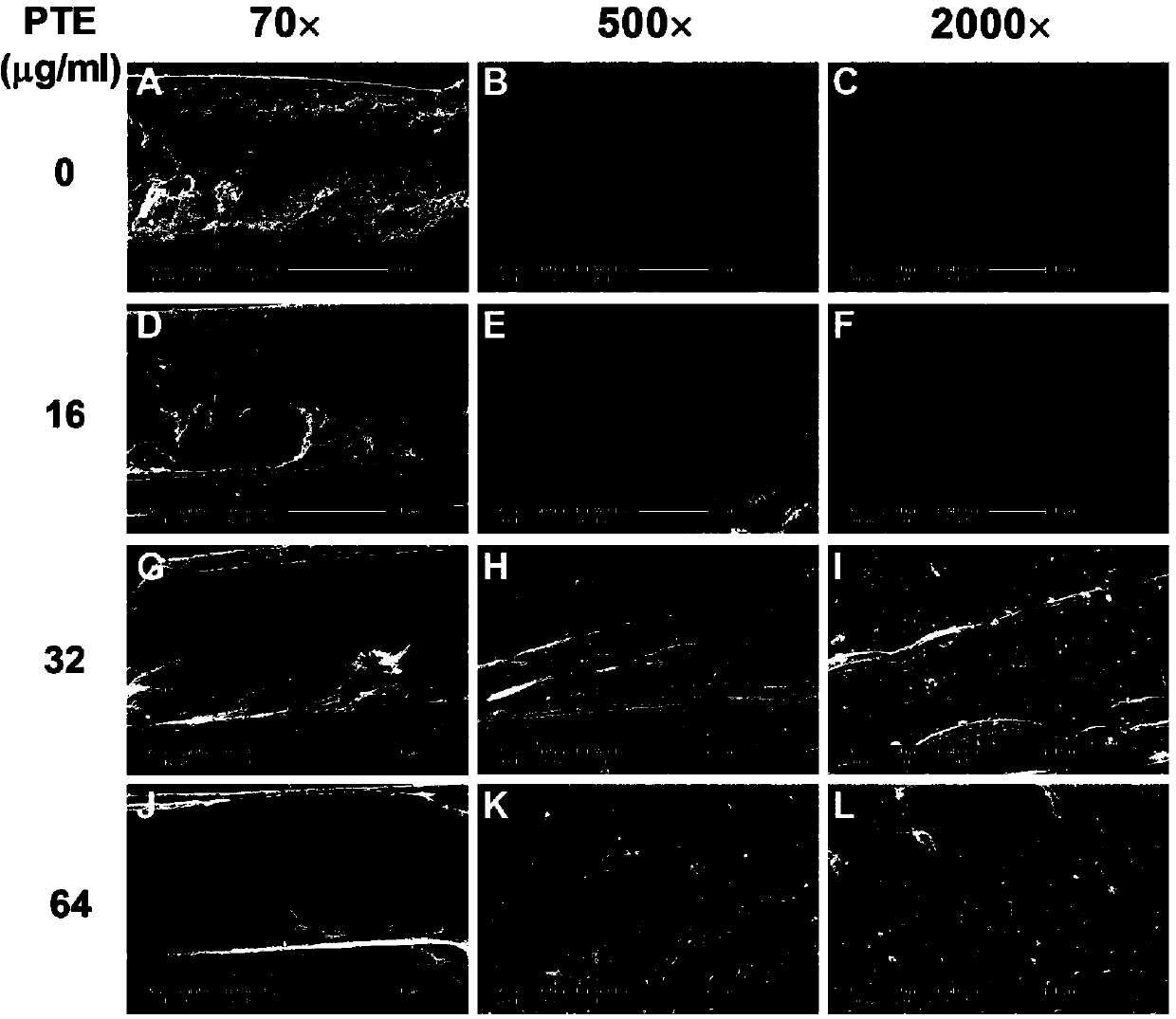 Application of pterostilbene in antifungal biofilm medicine