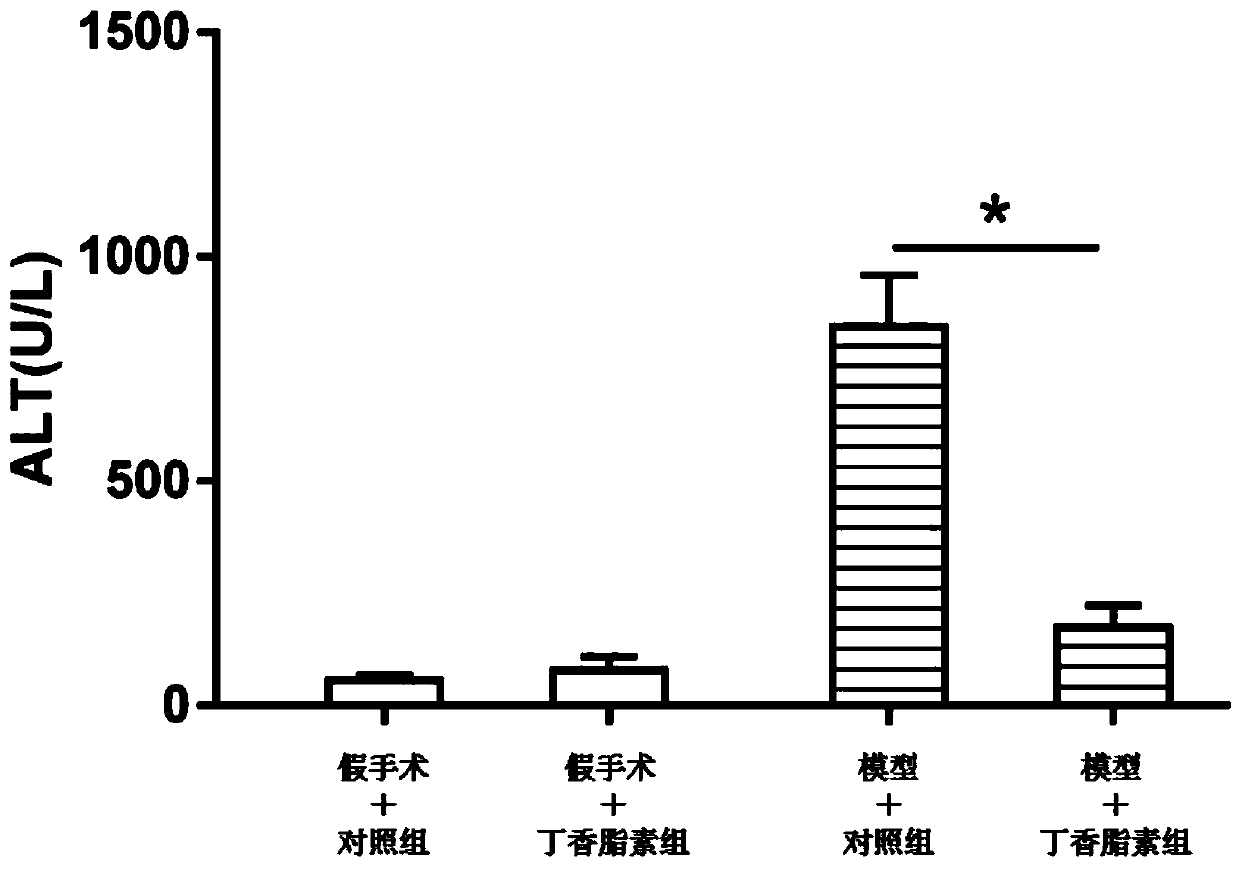 Application of syringaresinol in preparation of medicine for preventing and treating liver ischemia-reperfusion injury