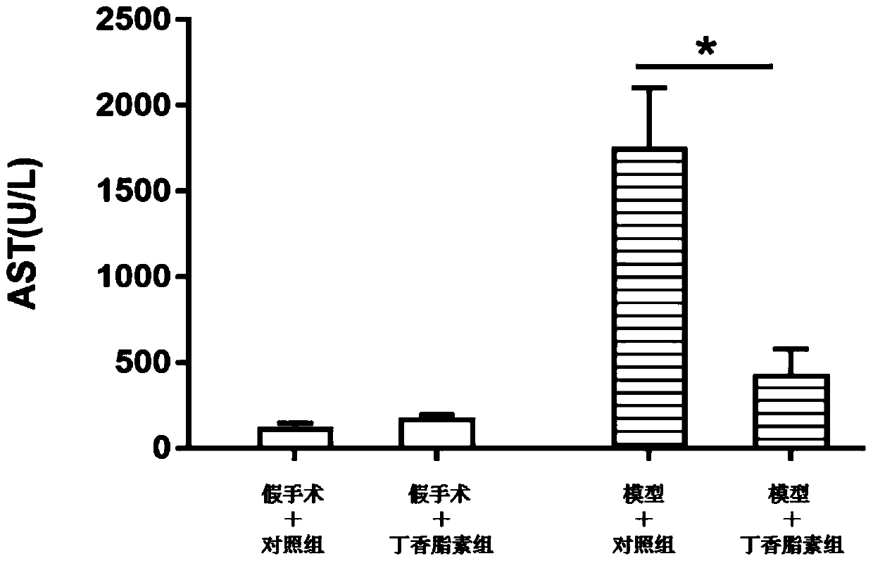 Application of syringaresinol in preparation of medicine for preventing and treating liver ischemia-reperfusion injury