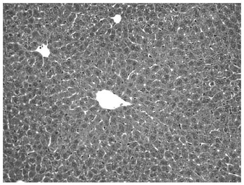 Application of syringaresinol in preparation of medicine for preventing and treating liver ischemia-reperfusion injury