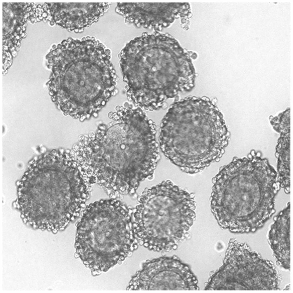 Culture solution, and method for improving quality of maternal diabetic ova