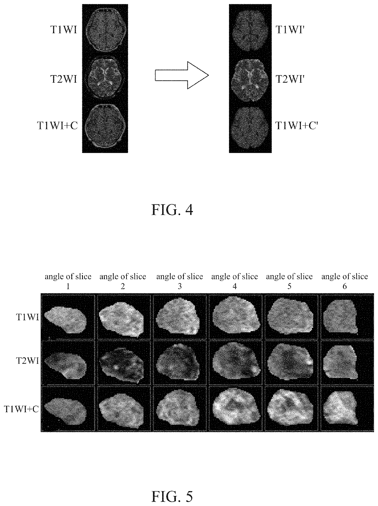 Tumor recurrence prediction device and method