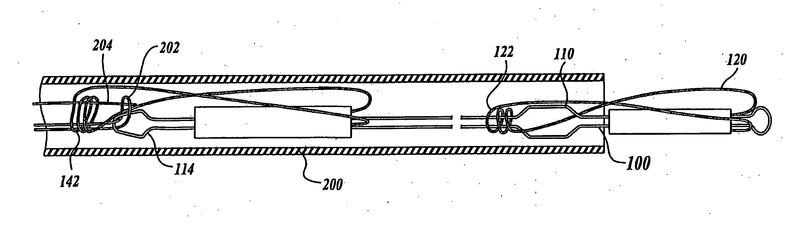 Device and method for modifying the shape of a body organ