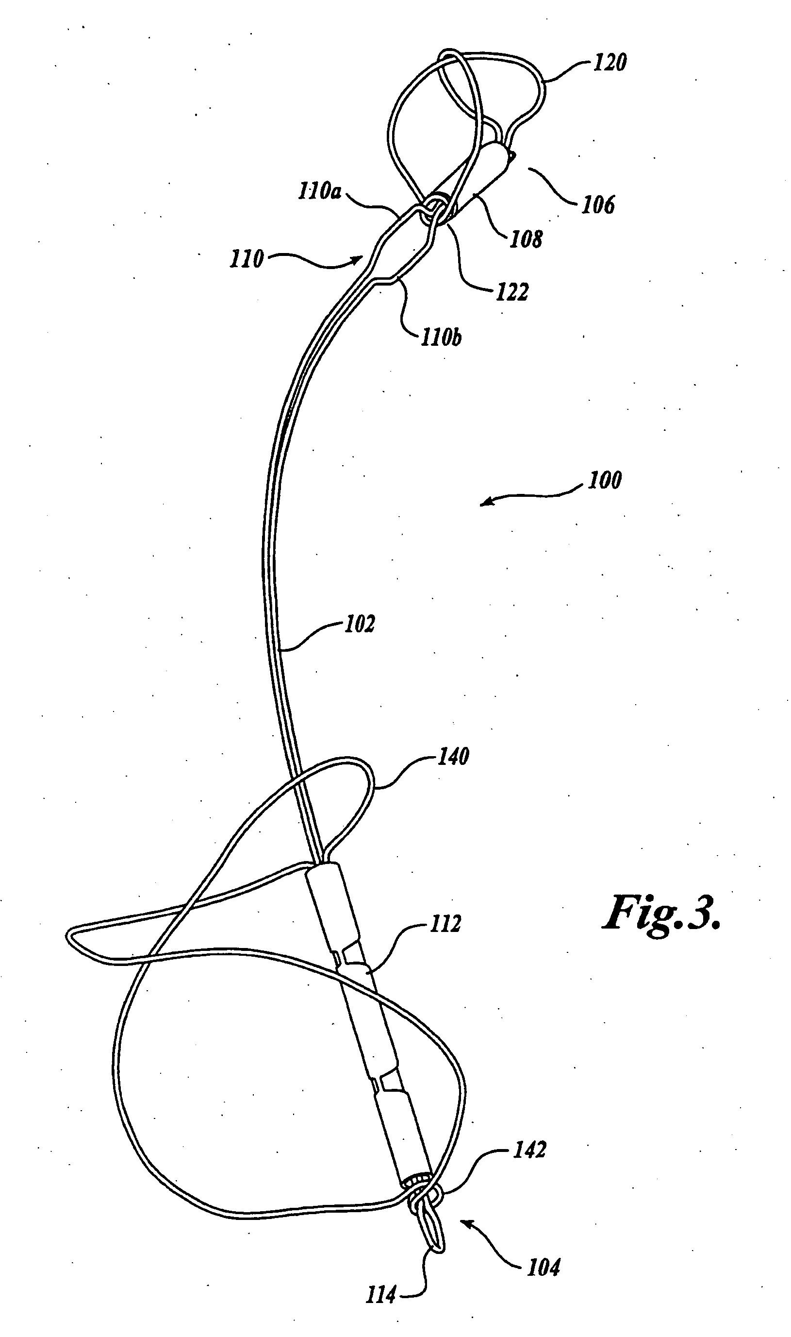 Device and method for modifying the shape of a body organ