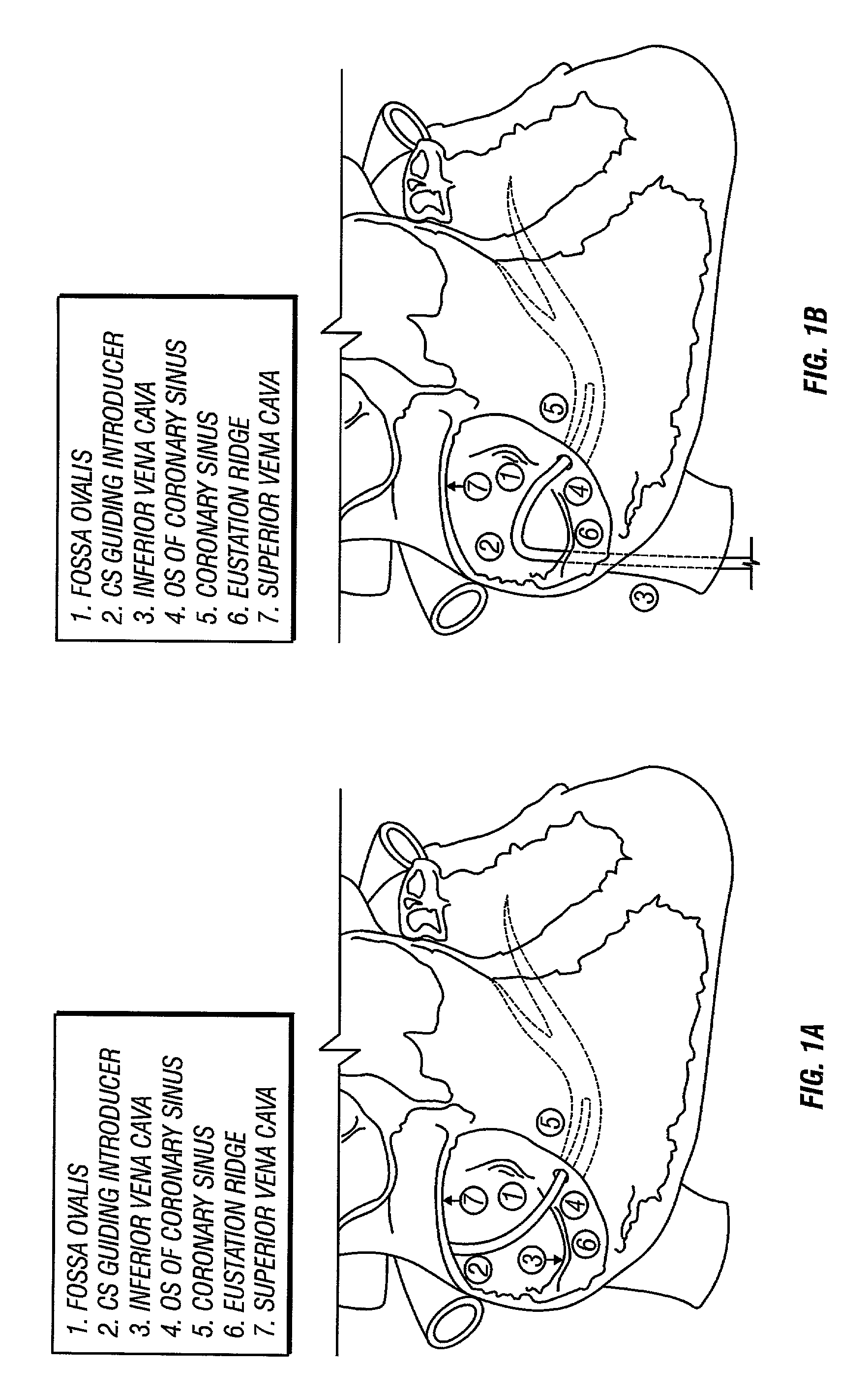 Introducer for accessing the coronary sinus of a heart