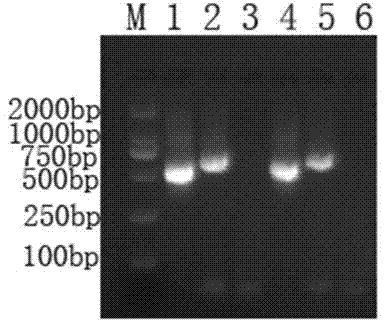 RT-PCR (Reverse Transcription-Polymerase Chain Reaction) primer for detecting European and American porcine reproductive and respiratory syndrome viruses and kit