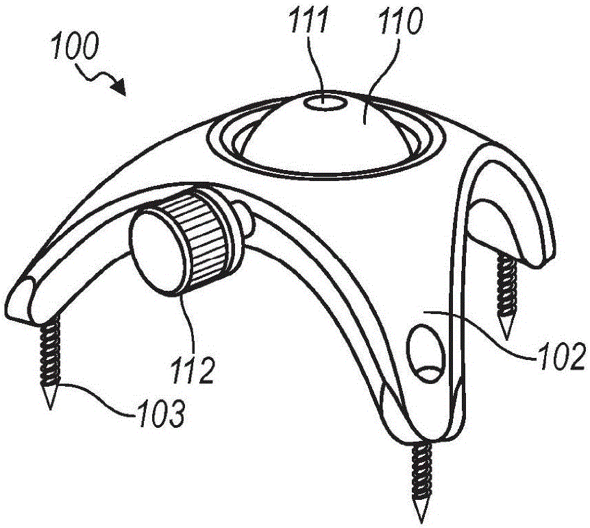 Stereotactic access devices and methods