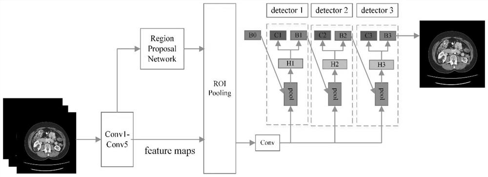 CT image auxiliary diagnosis system based on cascade connection