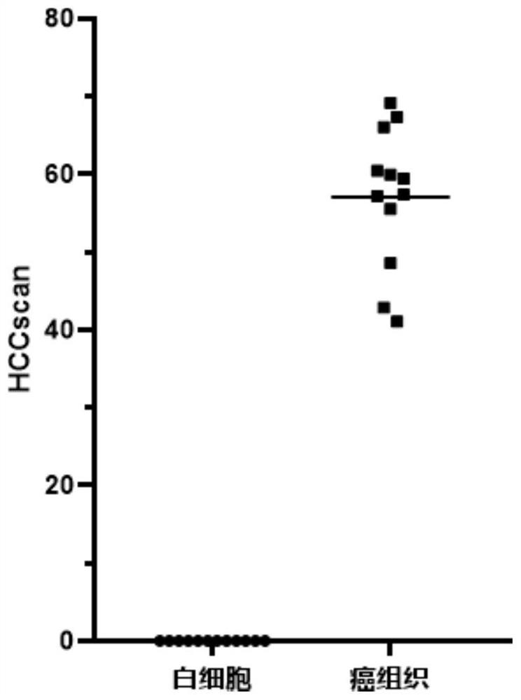 Combined marker for early diagnosis of liver cancer and application of combined marker.