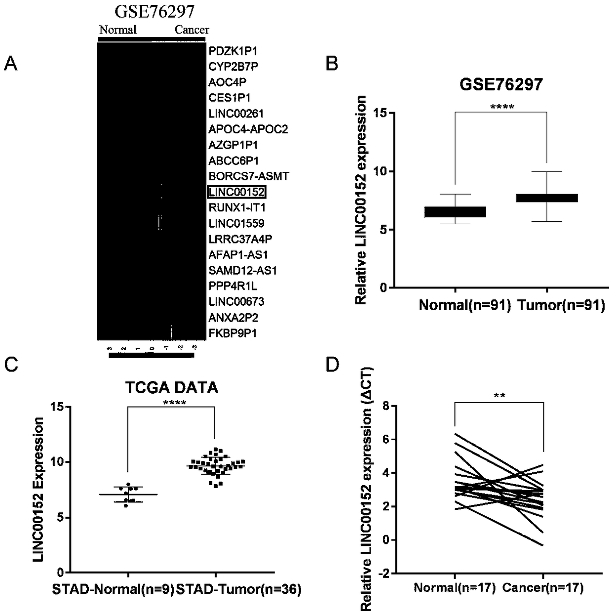 Application of long-chain non-coding RNA and composition thereof for diagnosing and treating biliary duct cancer