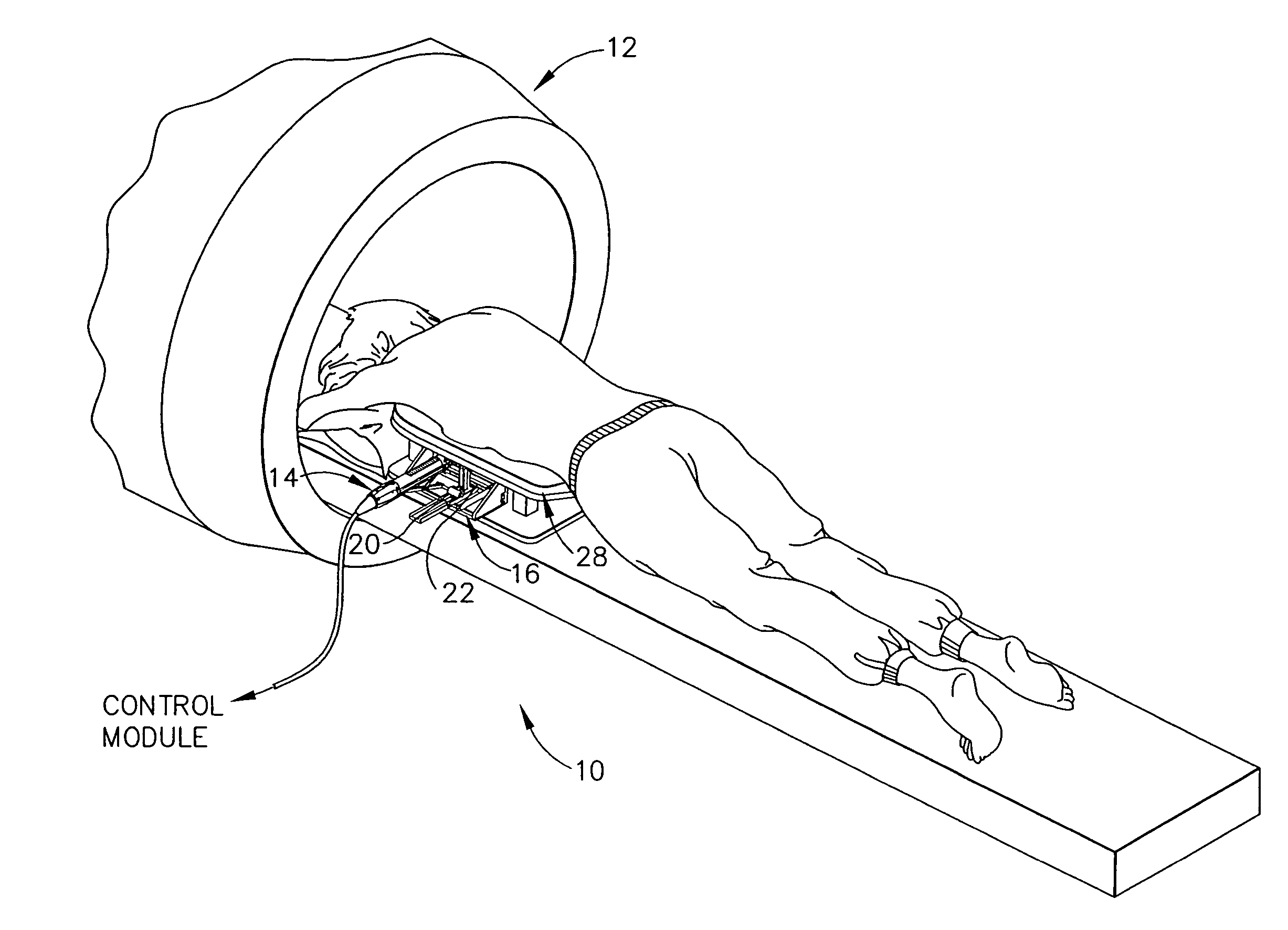 MRI biopsy device