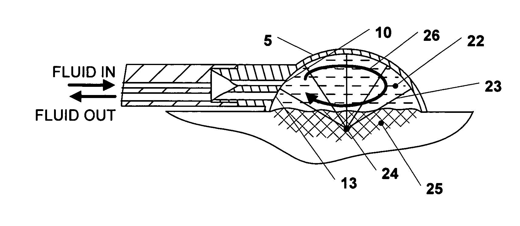 Apparatus and method for the treatment of tissue with ultrasound energy by direct contact