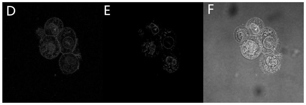 Simultaneous fluorescence imaging method for Hg2+ and Ag+ in cells