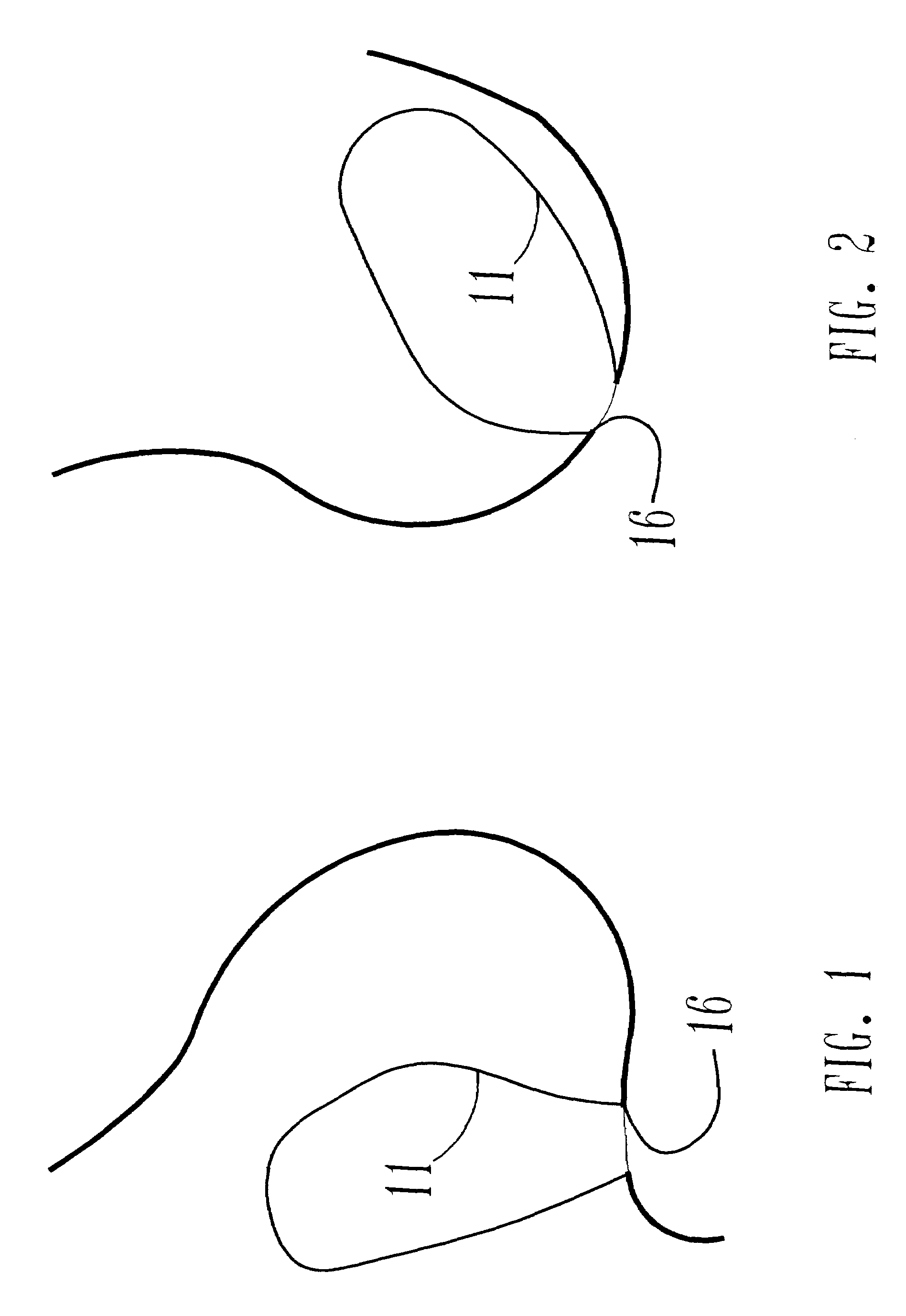 Apparatus and method for drainage