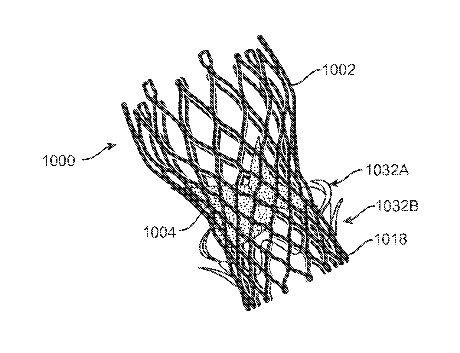 Anti-Paravalvular Leakage Component for a Transcatheter Valve Prosthesis