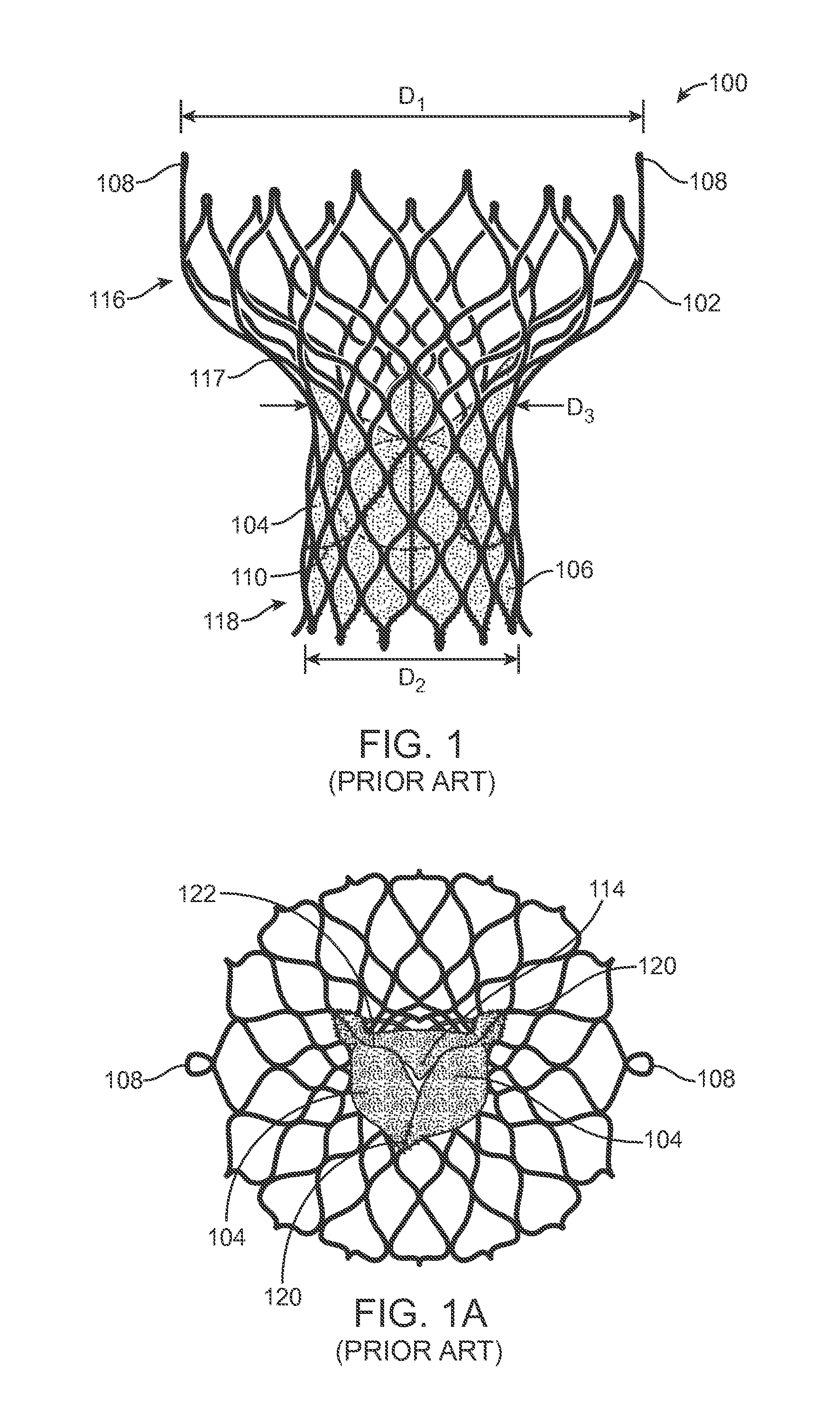 Anti-Paravalvular Leakage Component for a Transcatheter Valve Prosthesis