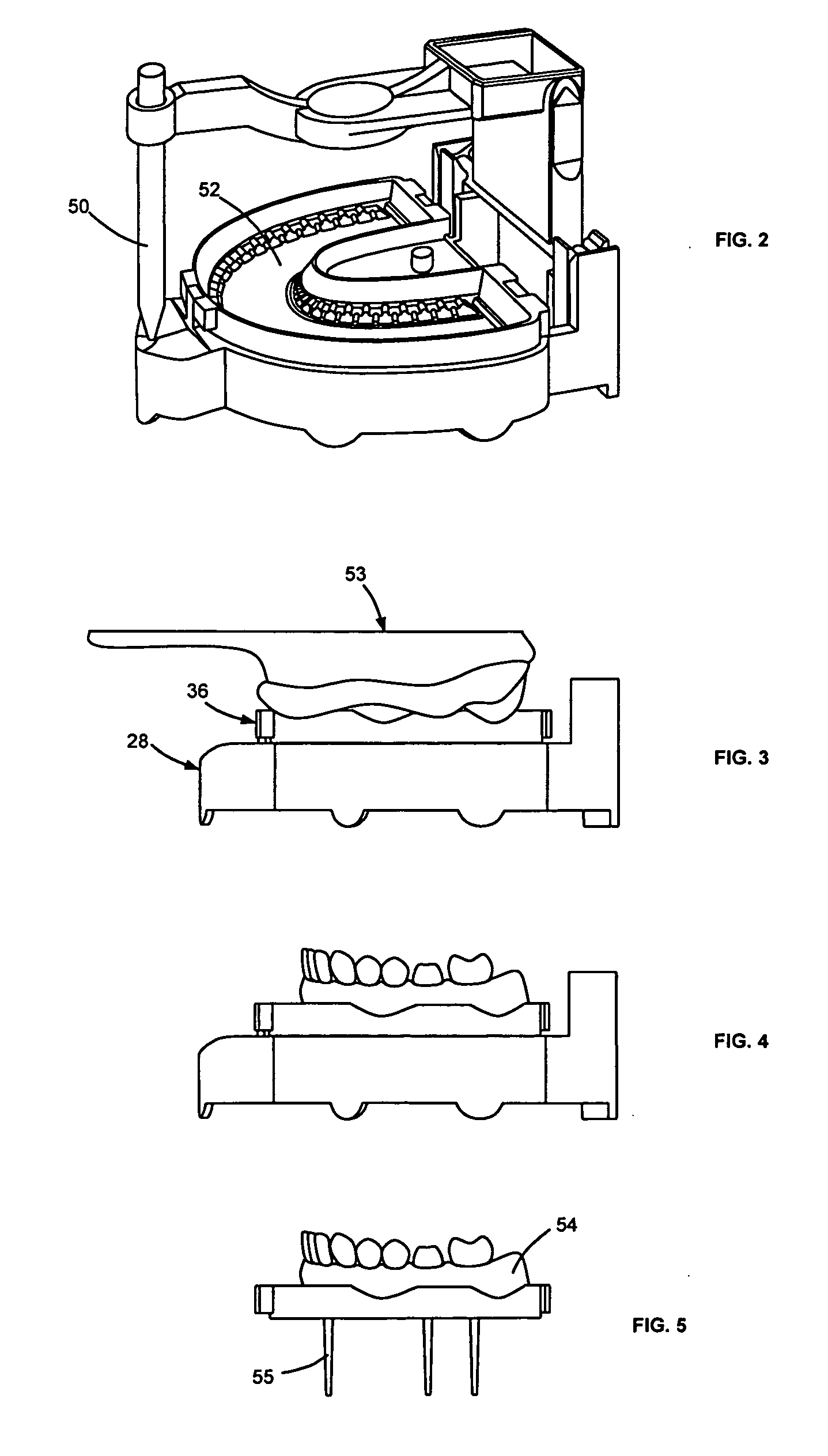 Dental model articulator