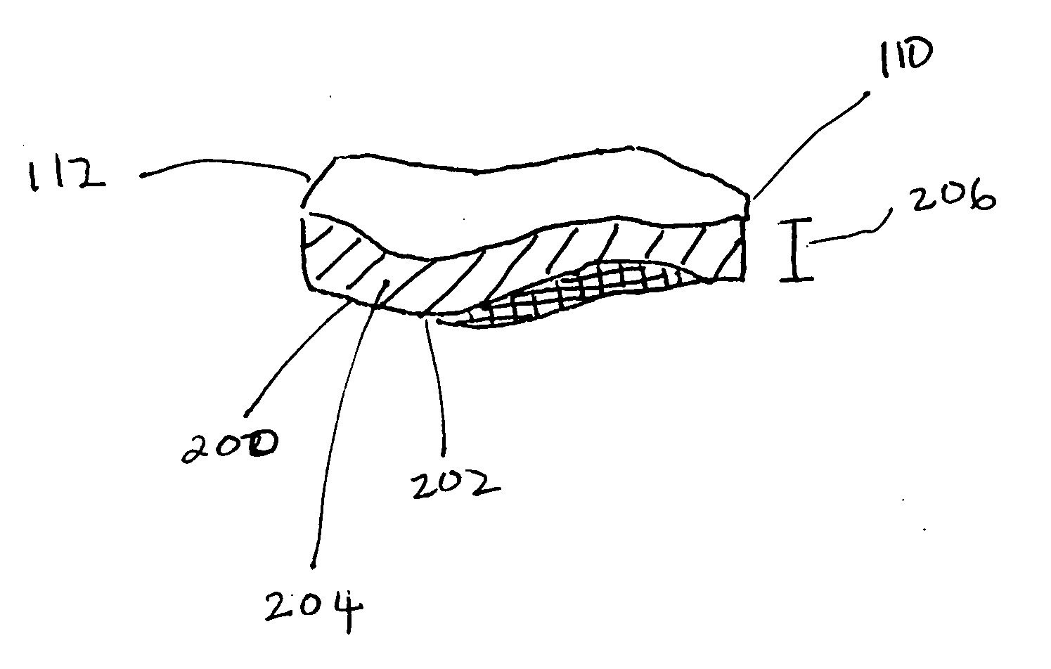 Meniscus prosthesis