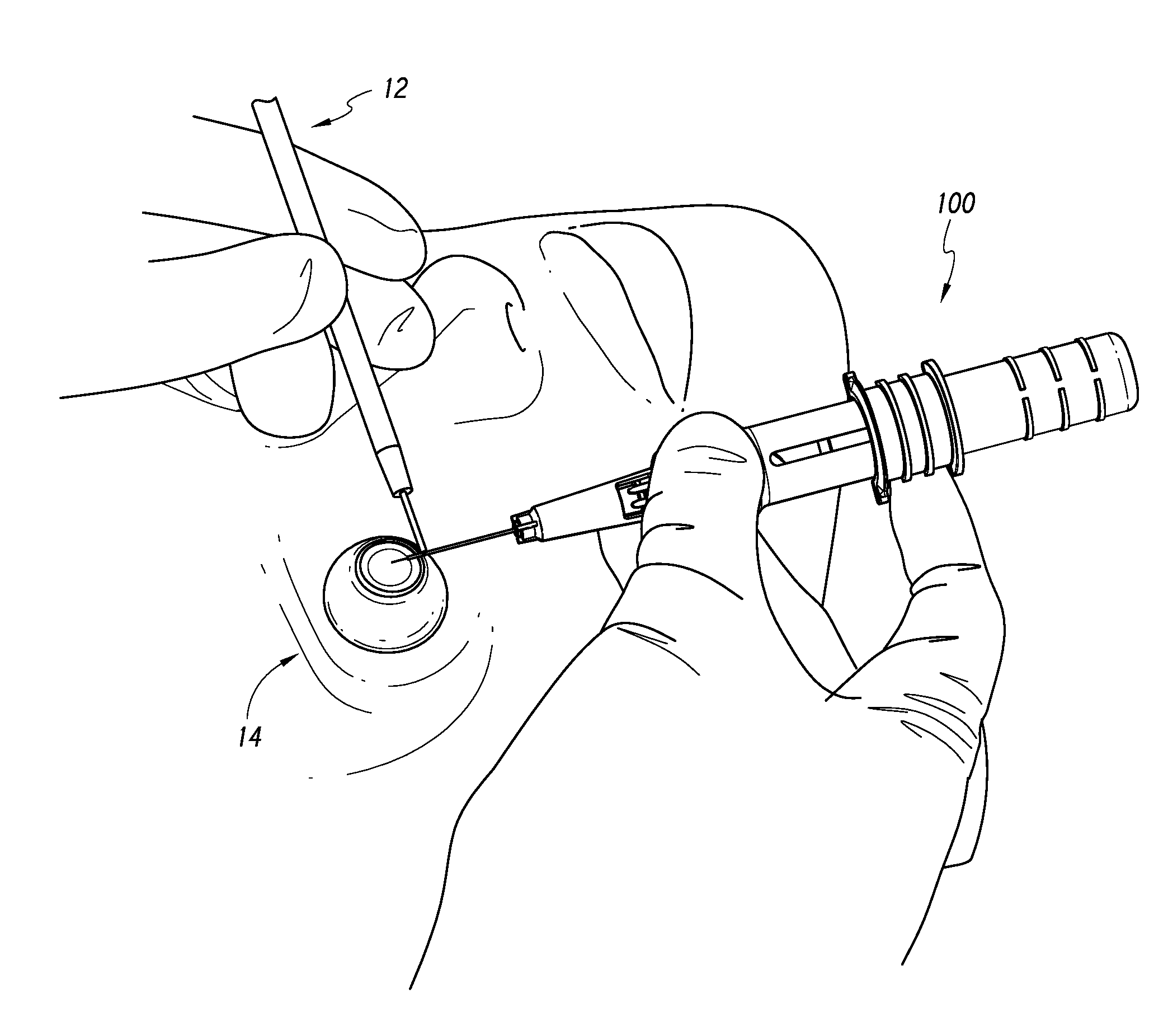 Intraocular shunt inserter