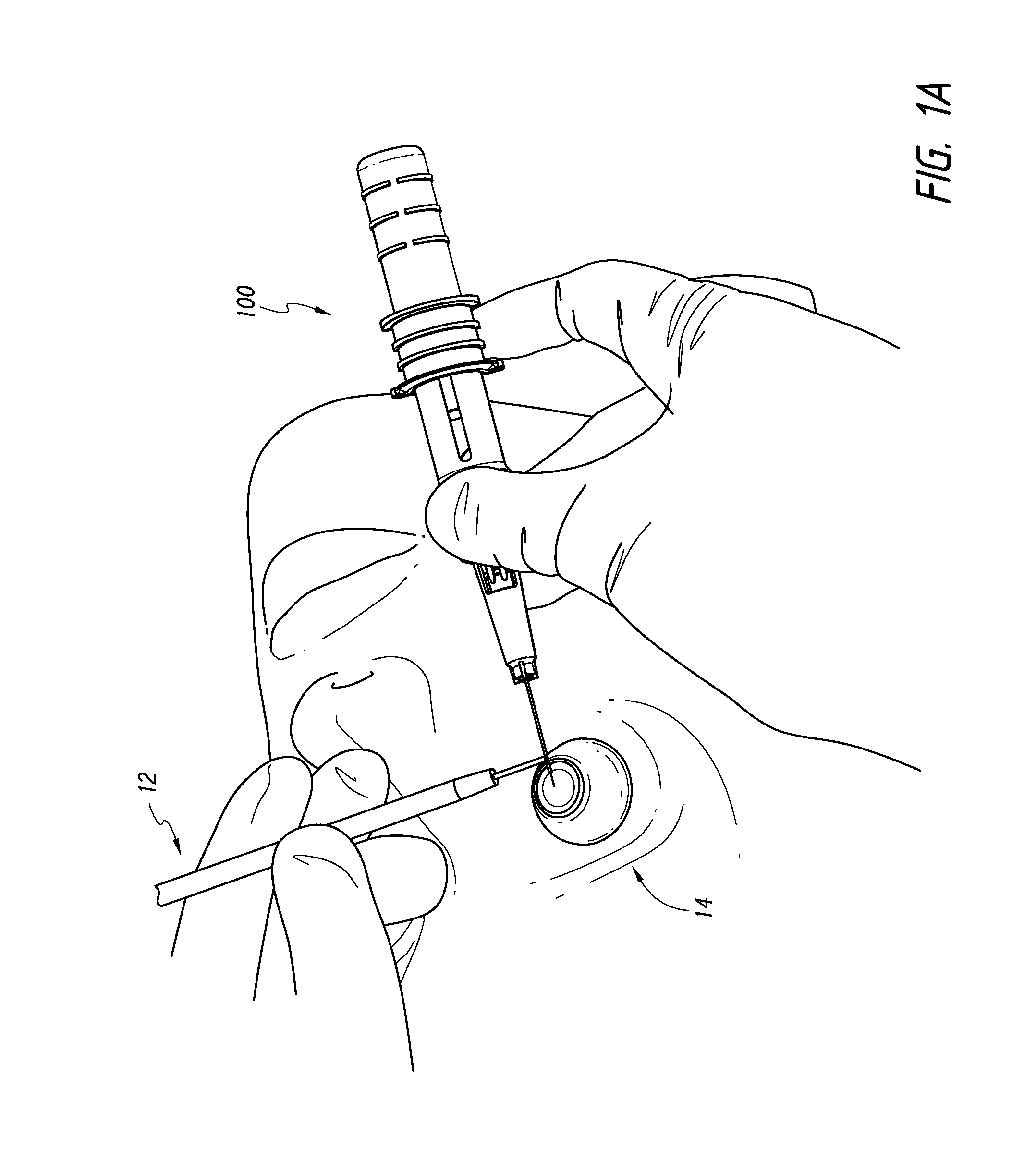 Intraocular shunt inserter