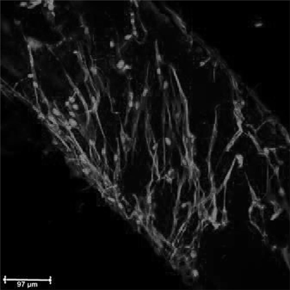 Photocuring 3D printing preparation method of degradable meniscus scaffold