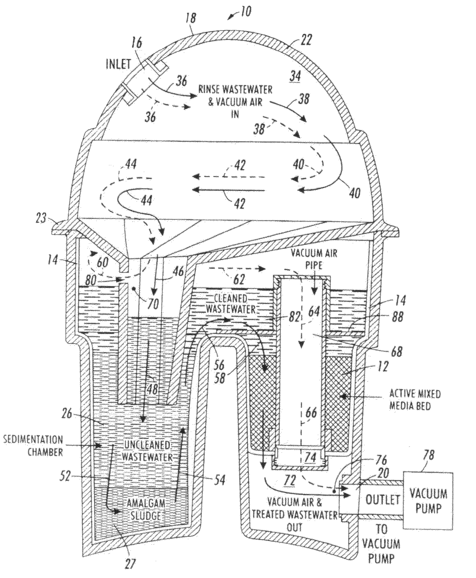 Amalgam separator