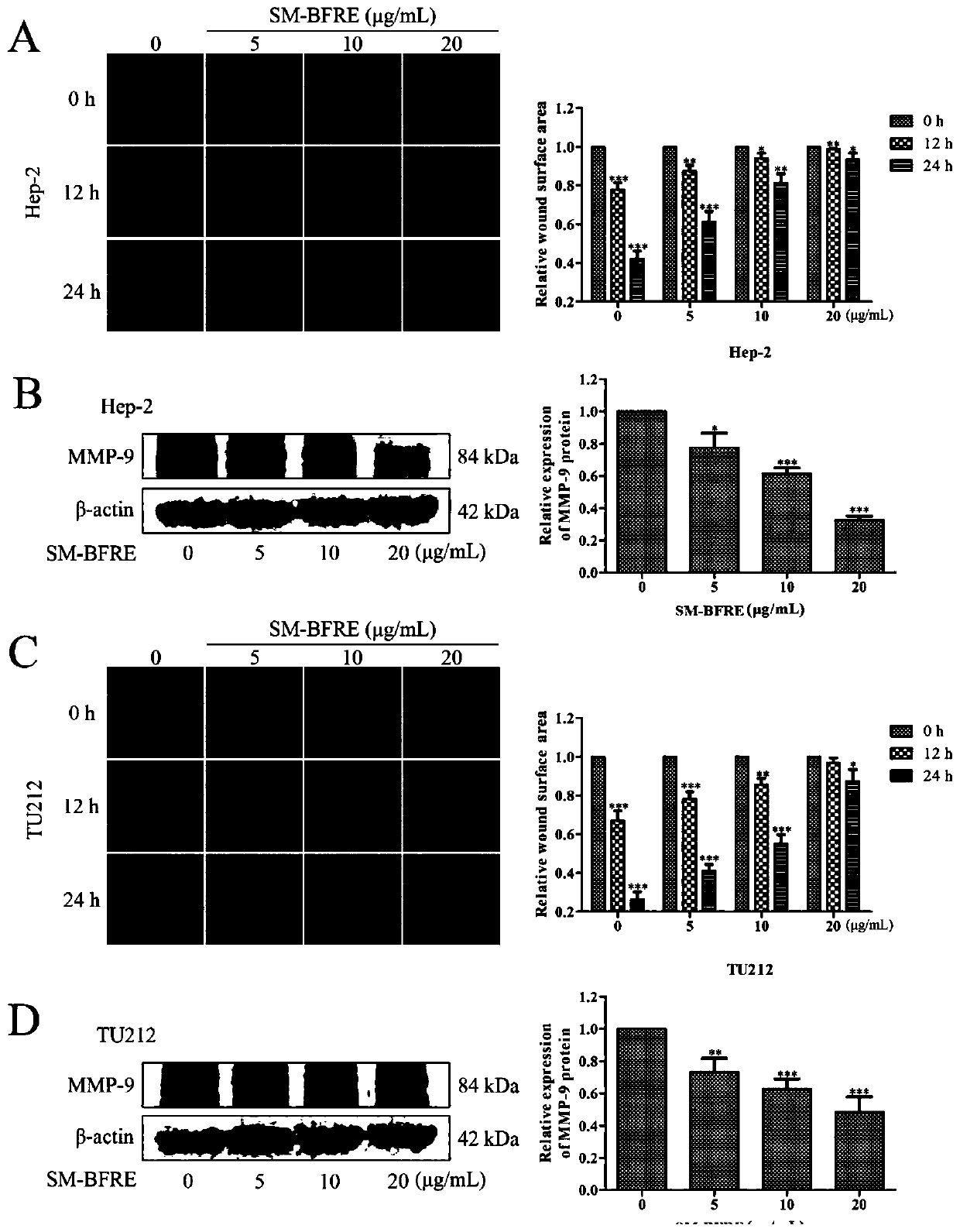 Pharmaceutical composition for treating laryngeal cancer as well as preparation method and application of pharmaceutical composition