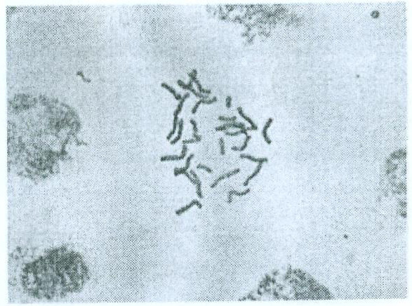 Method for making hyacinth root tip chromosome slice