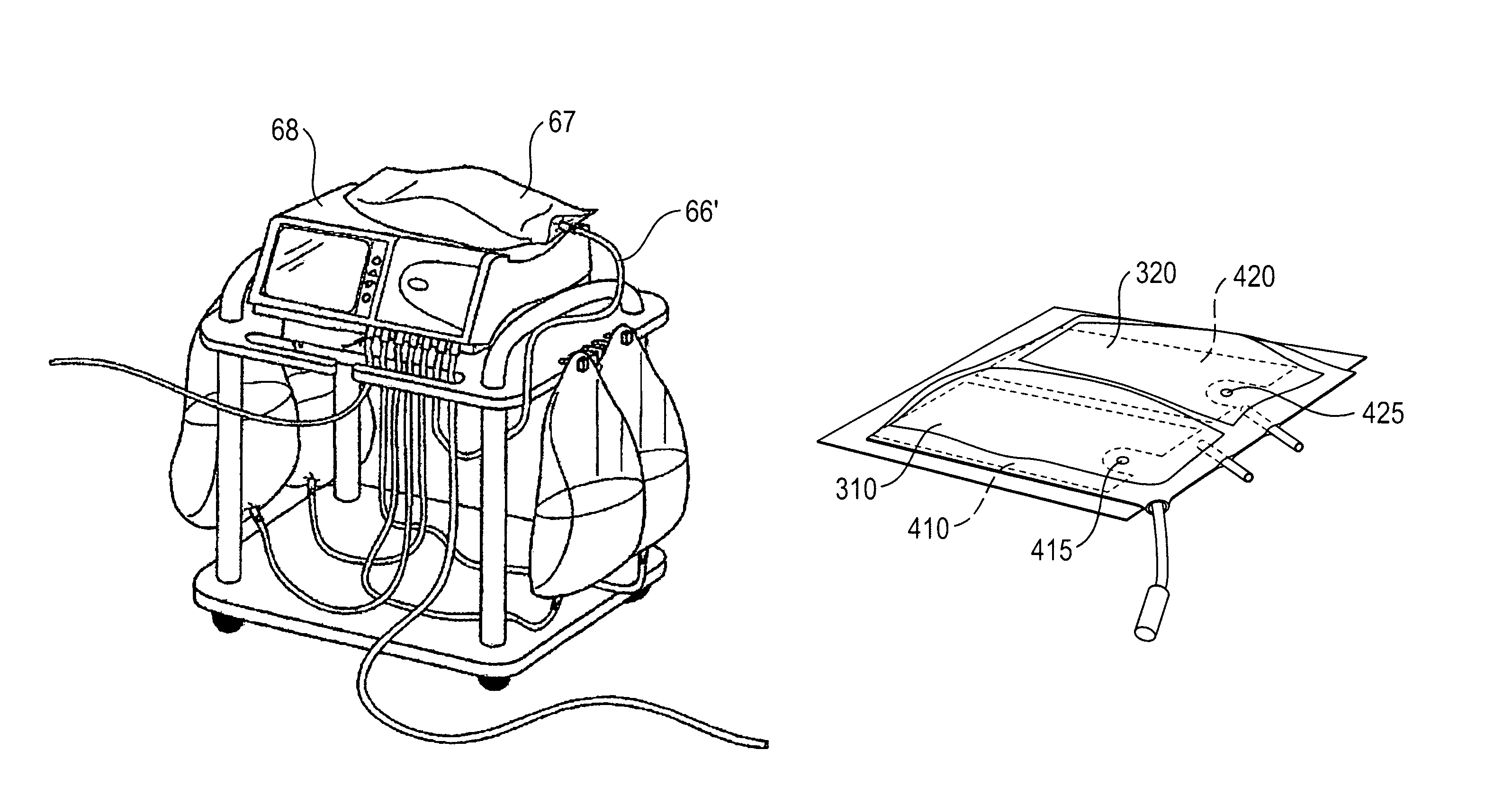 Dialysis machine, in particular peritoneal dialysis machine